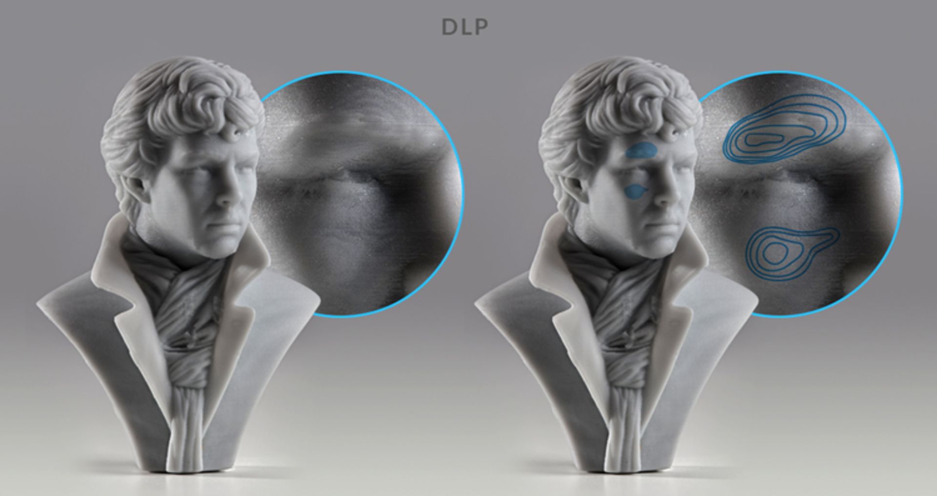 DLP and SLA