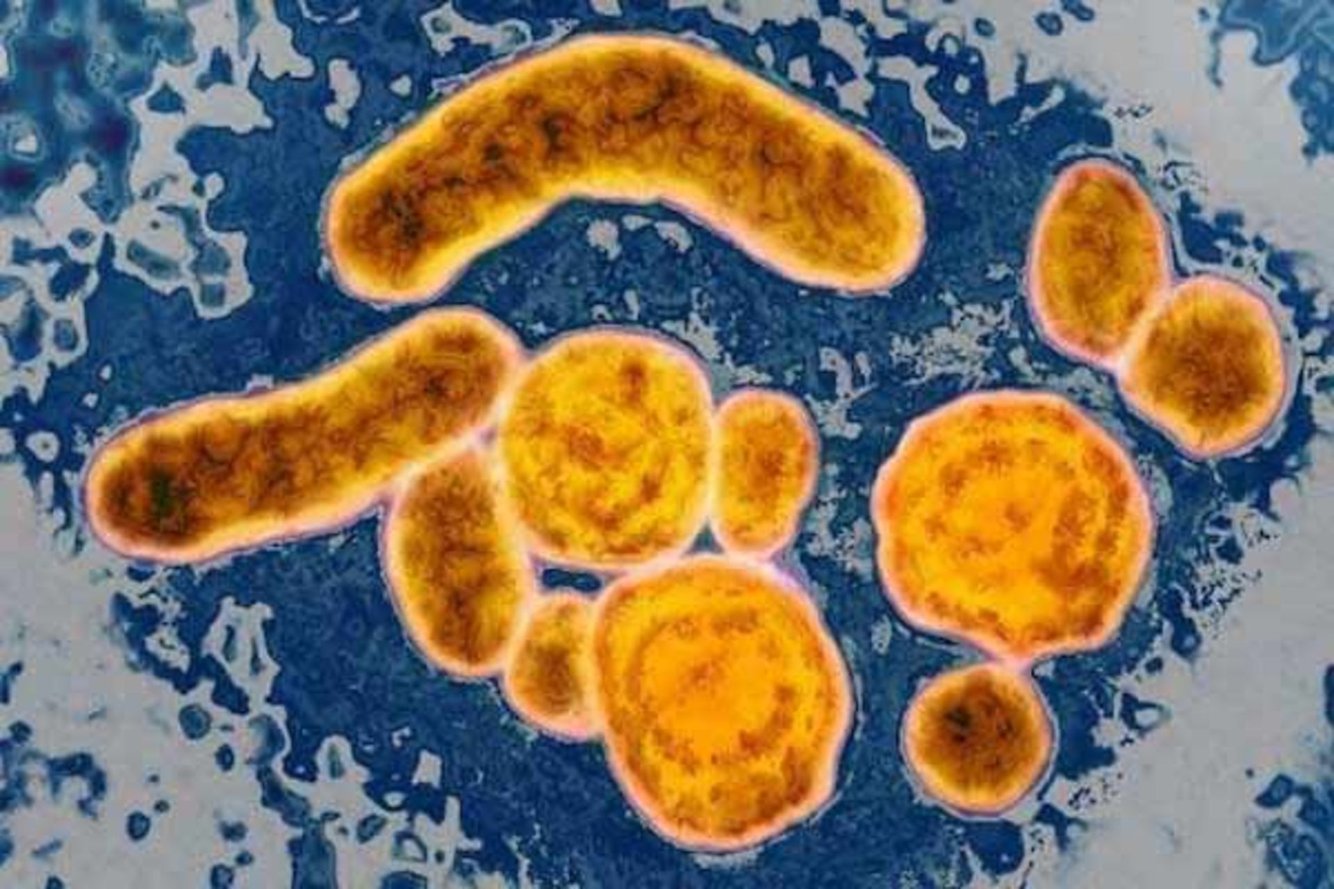 کشف قدیمی‌ترین ویروس در اسکلت یک انسان ۴۵۰۰ ساله