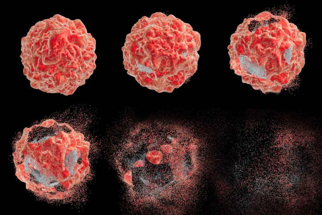 تومور / tumor