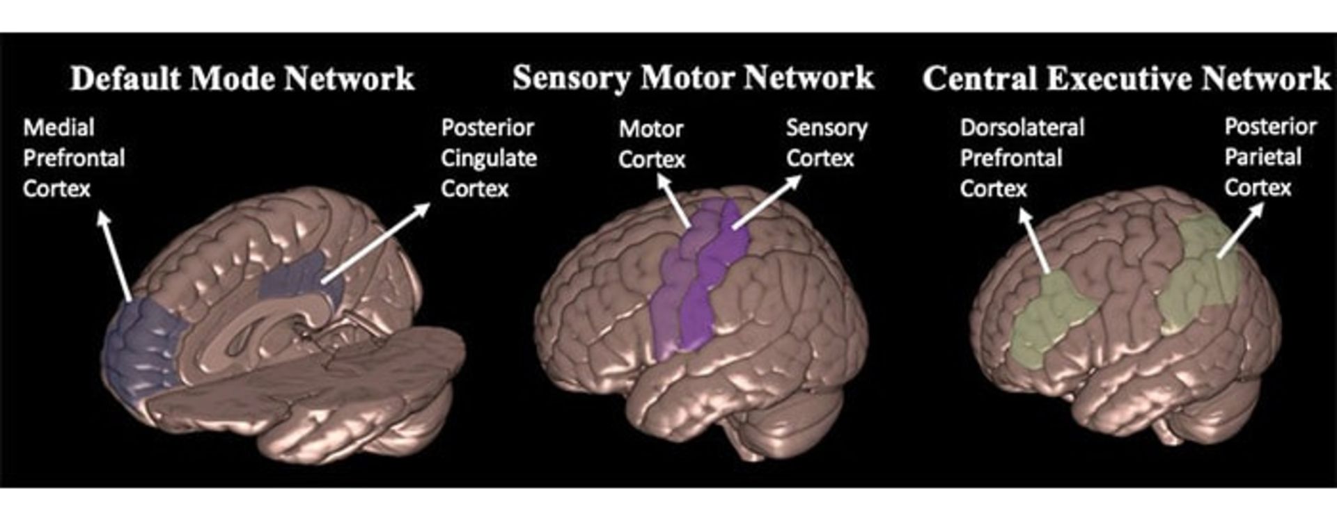 مغز در حال خواب