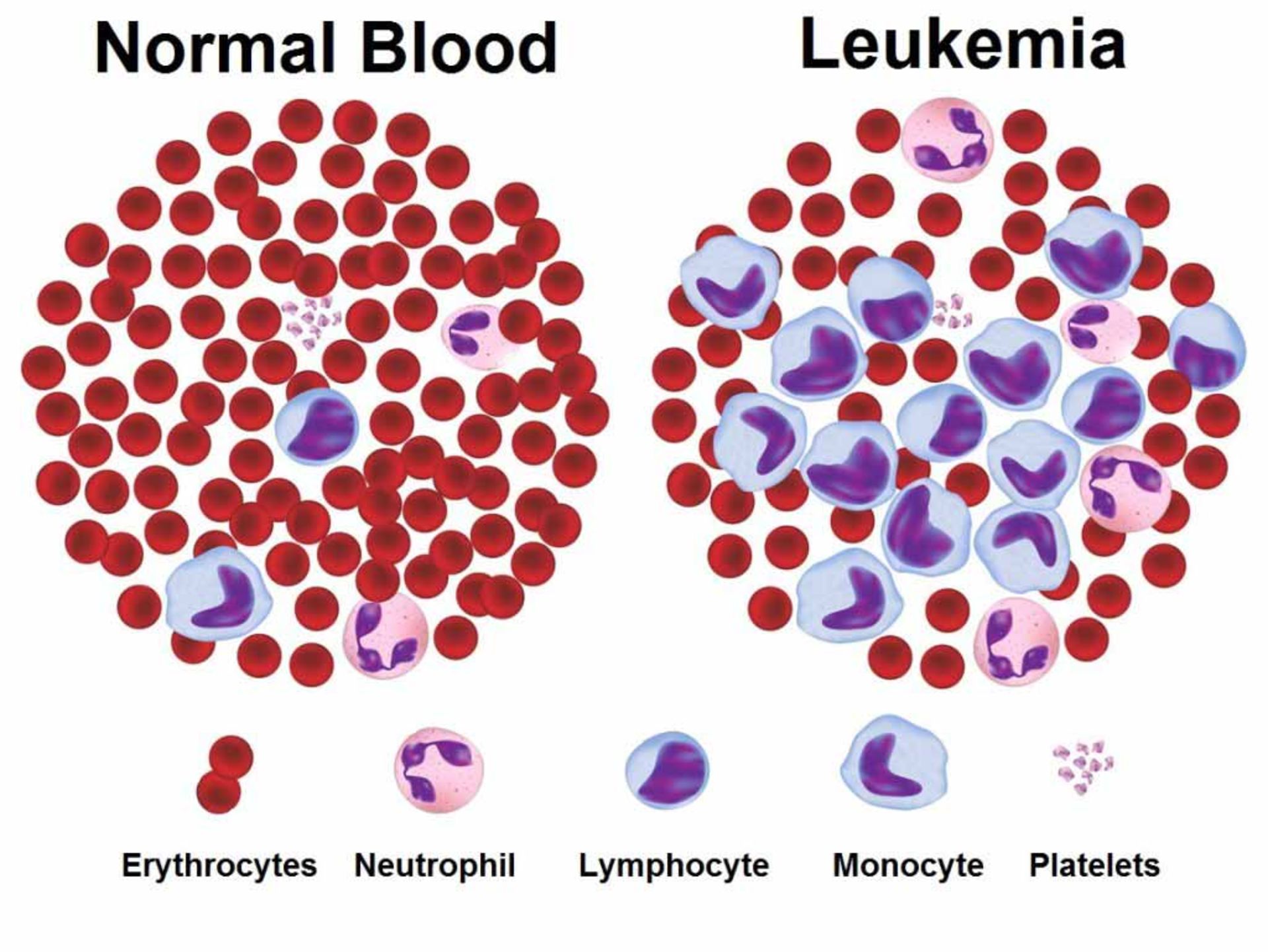 سلول سرطانی / cancer cell