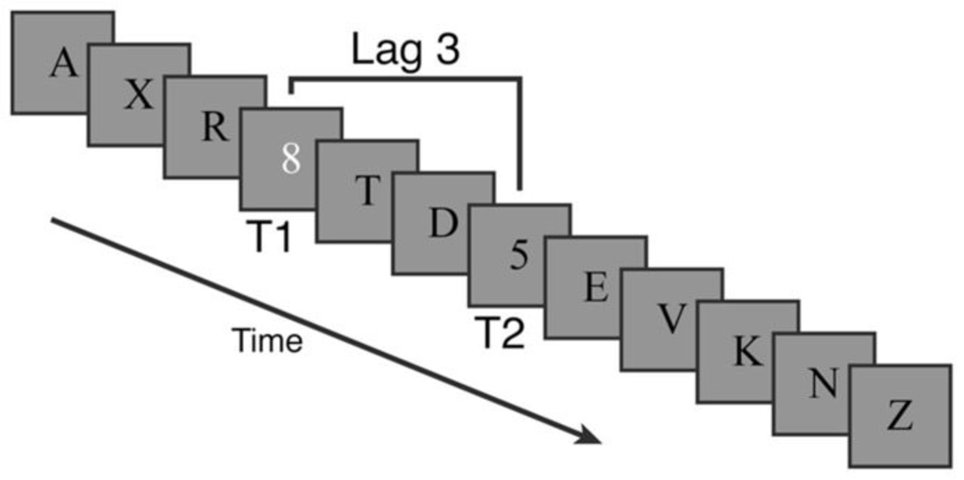 attentional blink