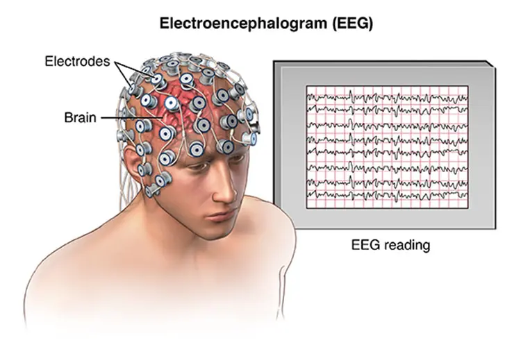 EEG