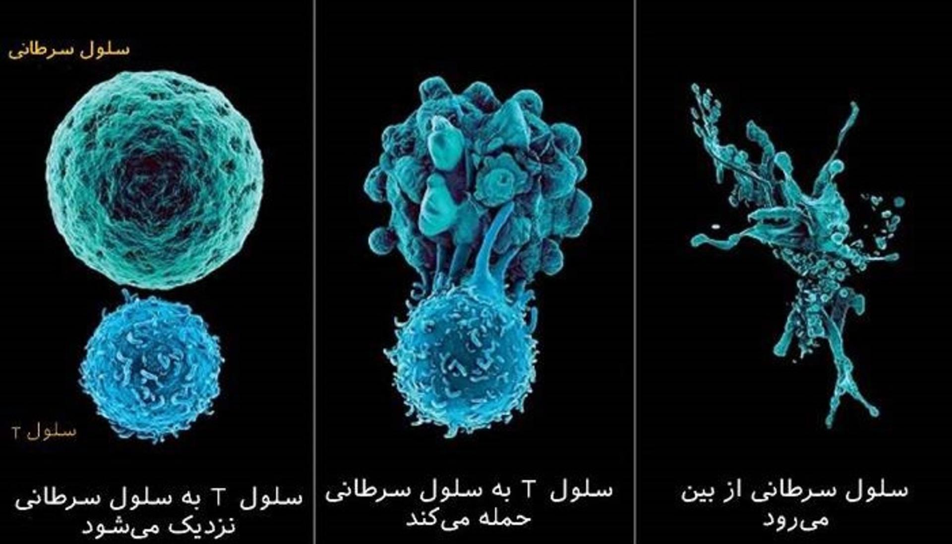 ایمنی درمانی سرطان