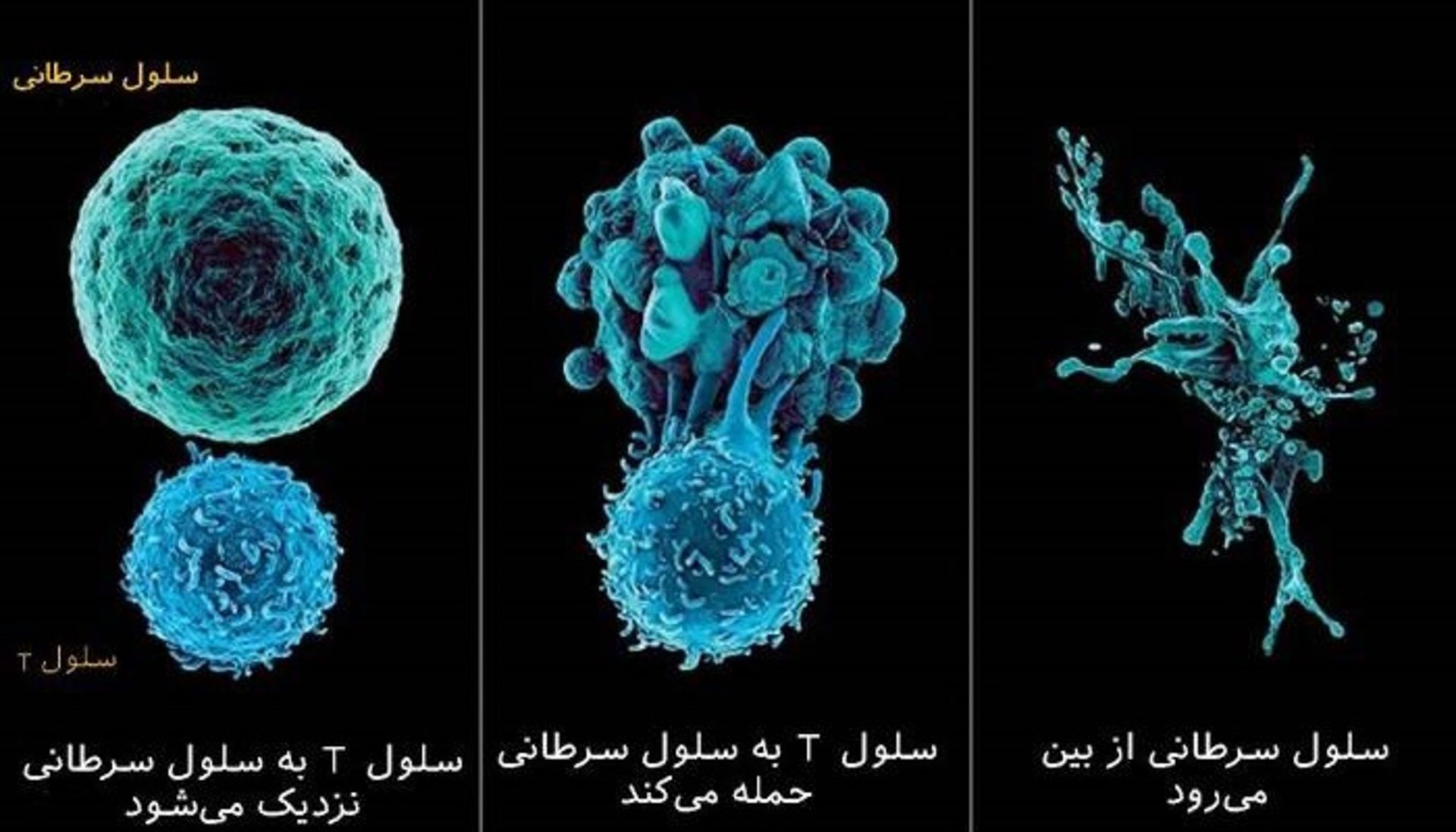 ایمنی درمانی سرطان