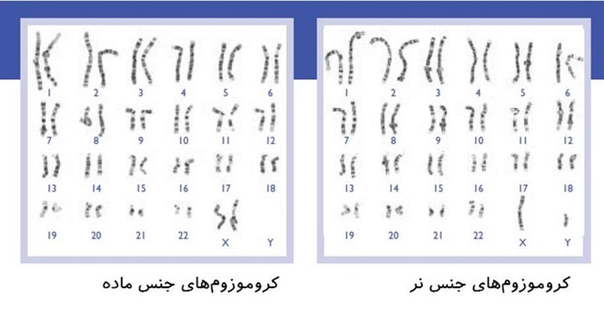 کاریوتایپ انسان طبیعی