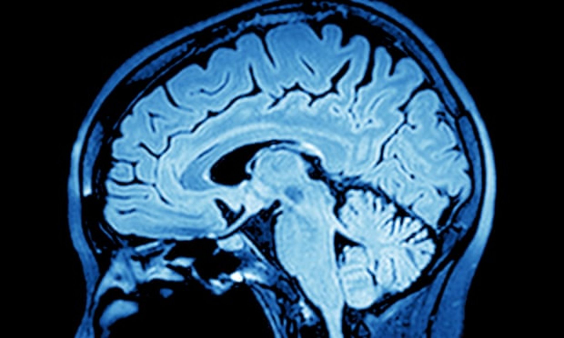 ارزیابی مغز