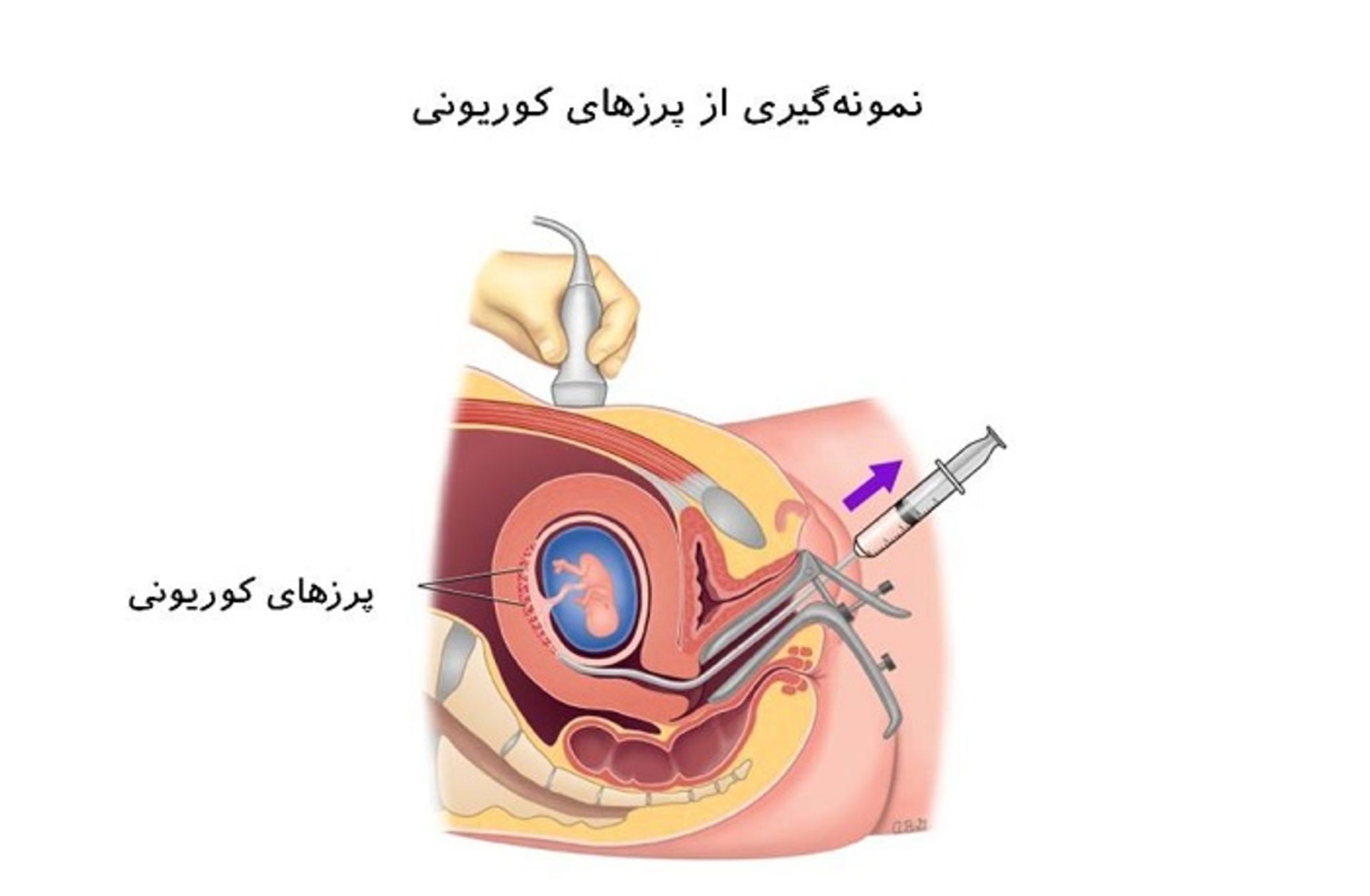 نمونه گیری از پرزهای جفتی