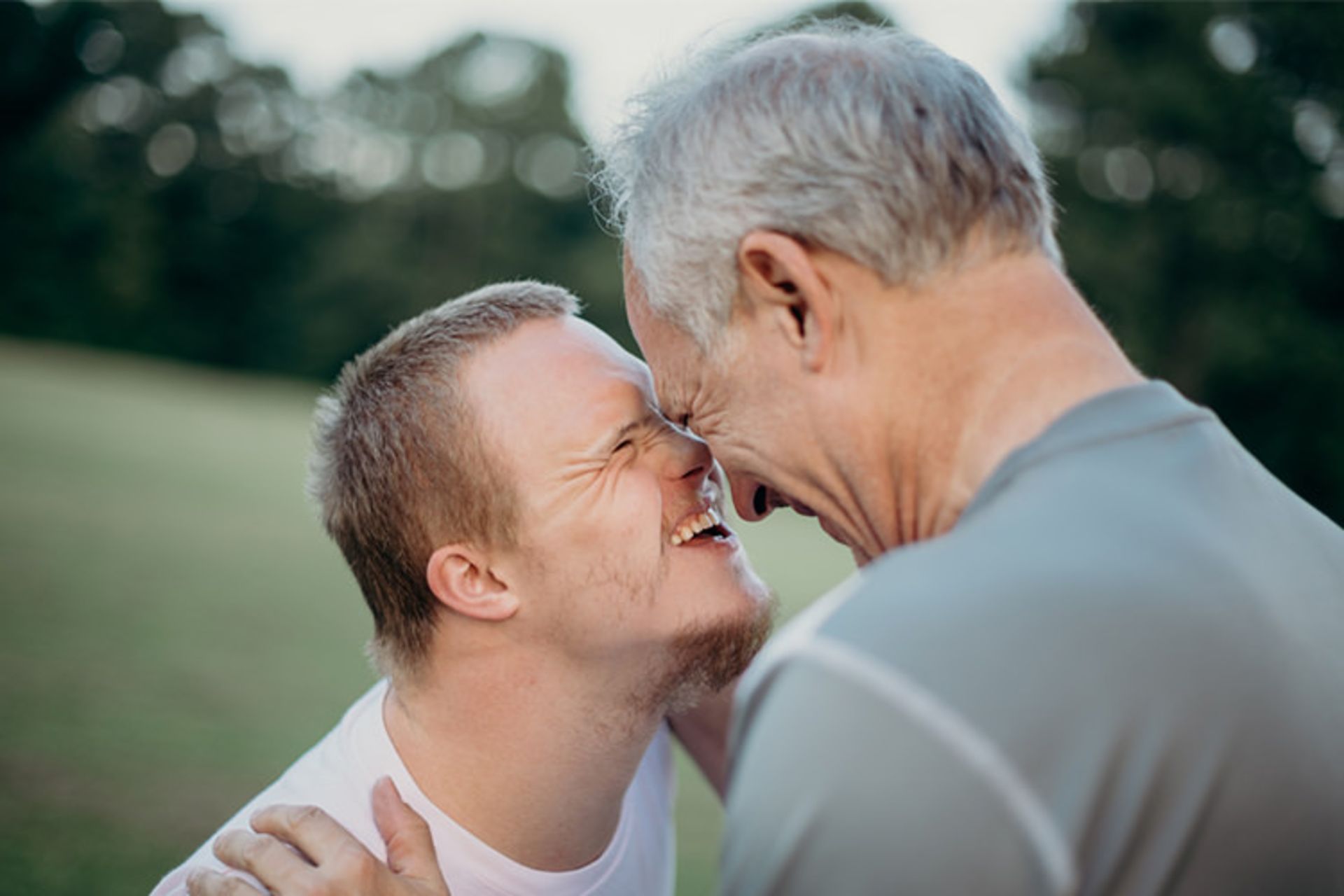 سندروم داون