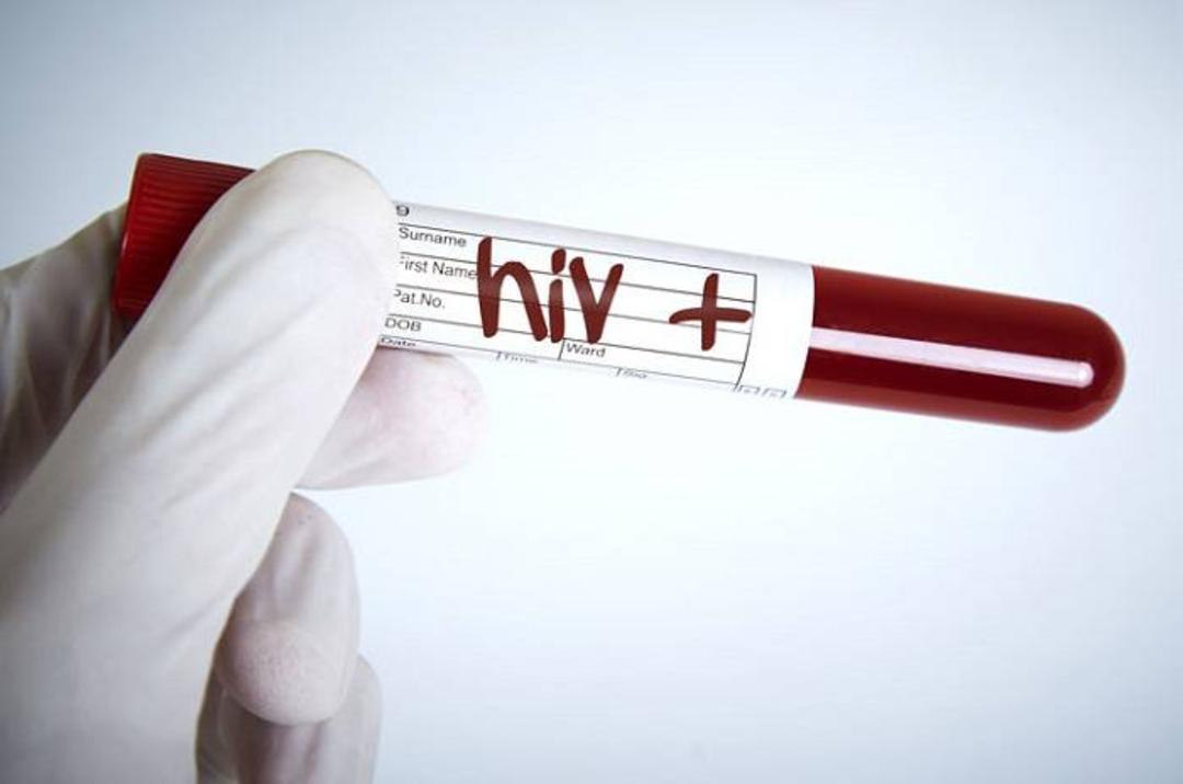 HIV