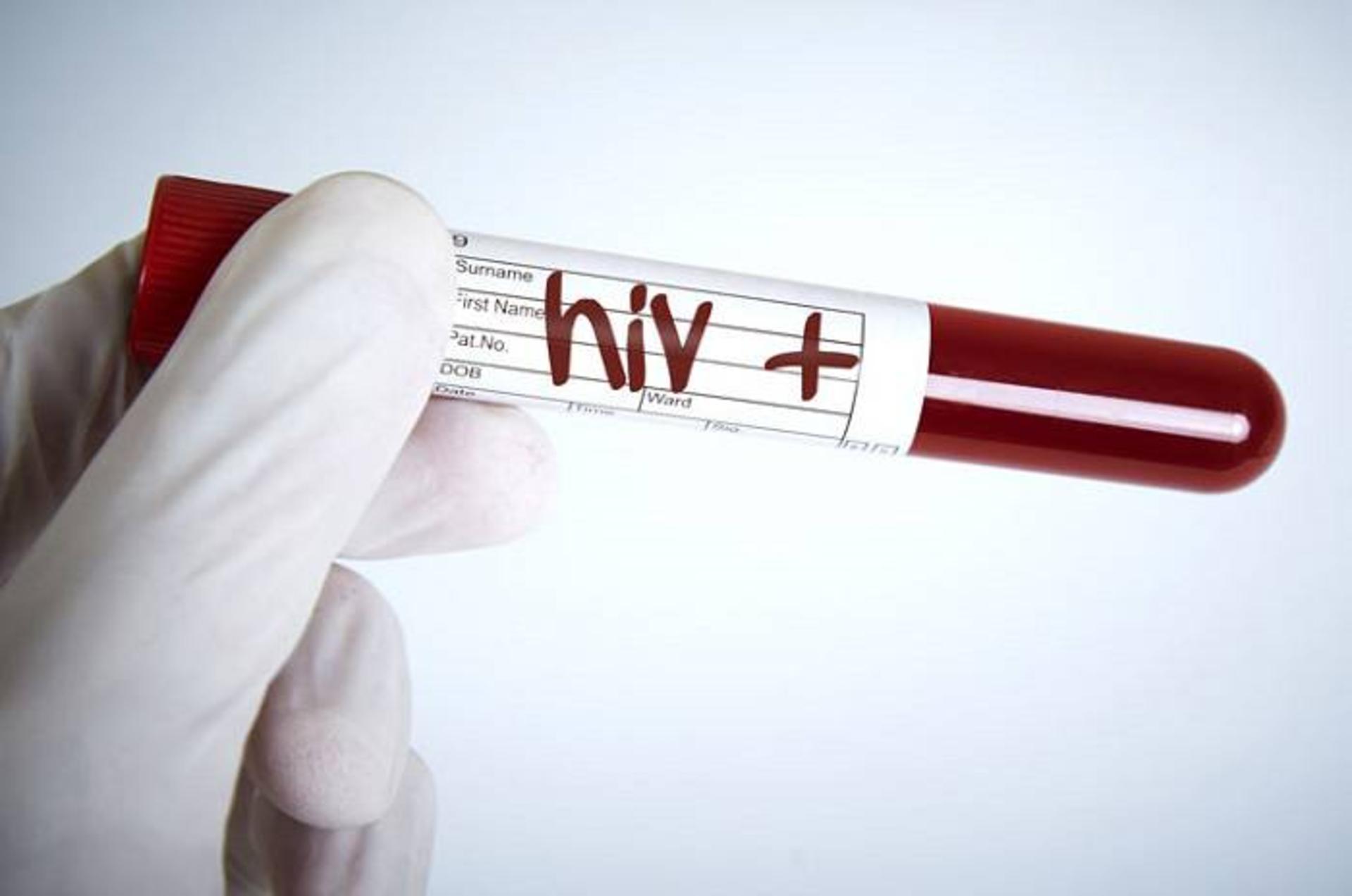 HIV