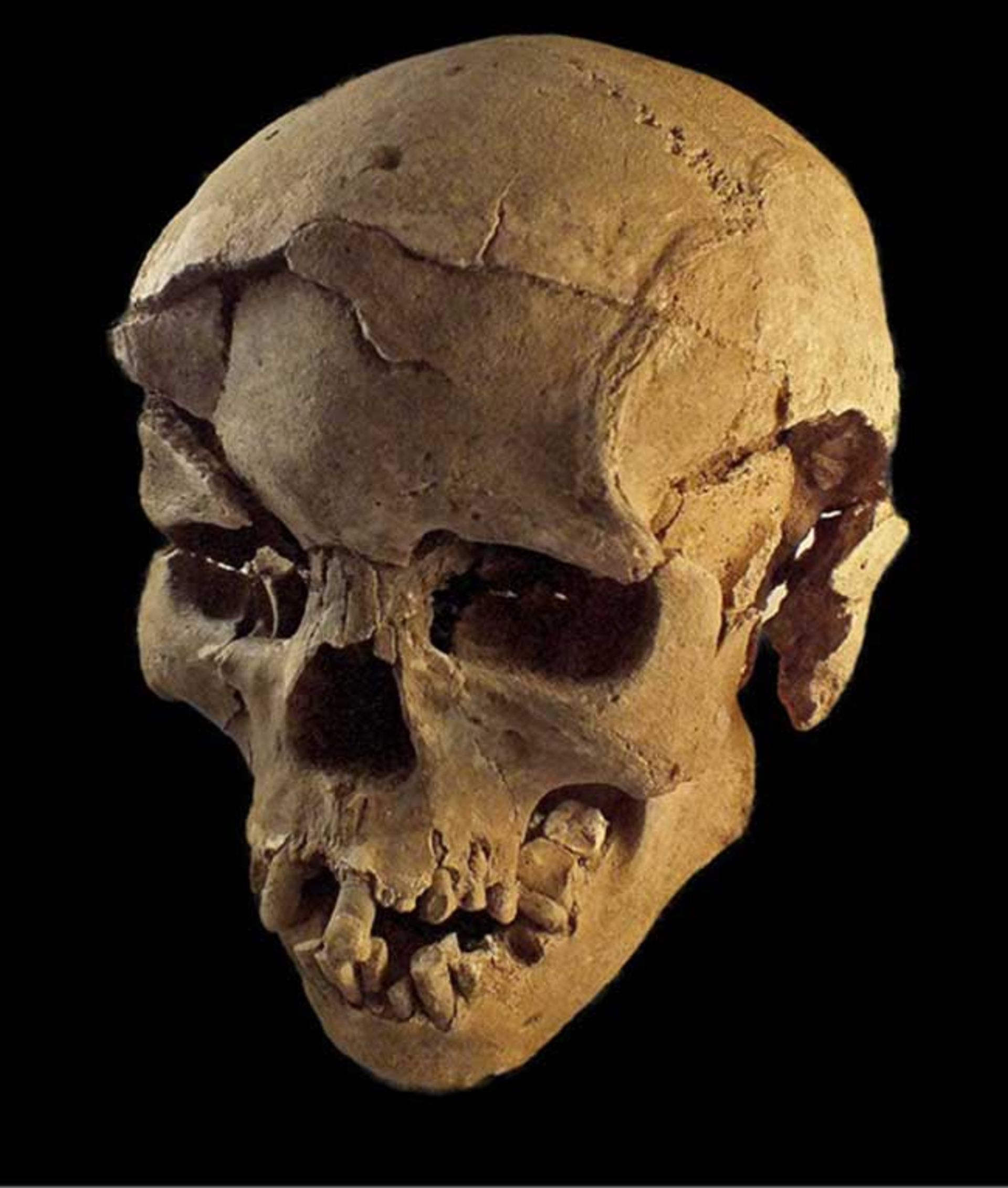 قربانی یک درگیری خونین ماقبل تاریخی 