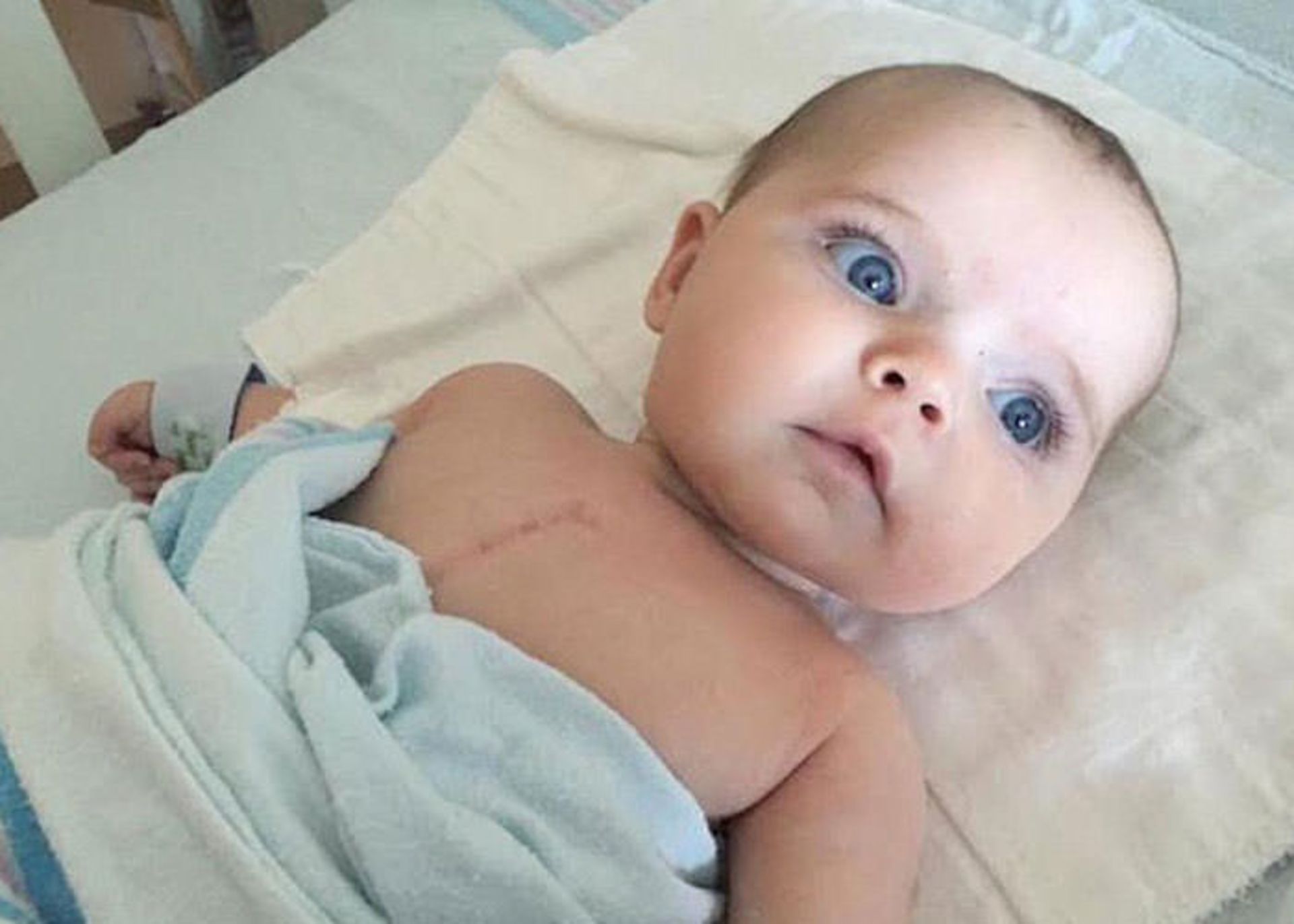  بیماری قلبی مادرزادی