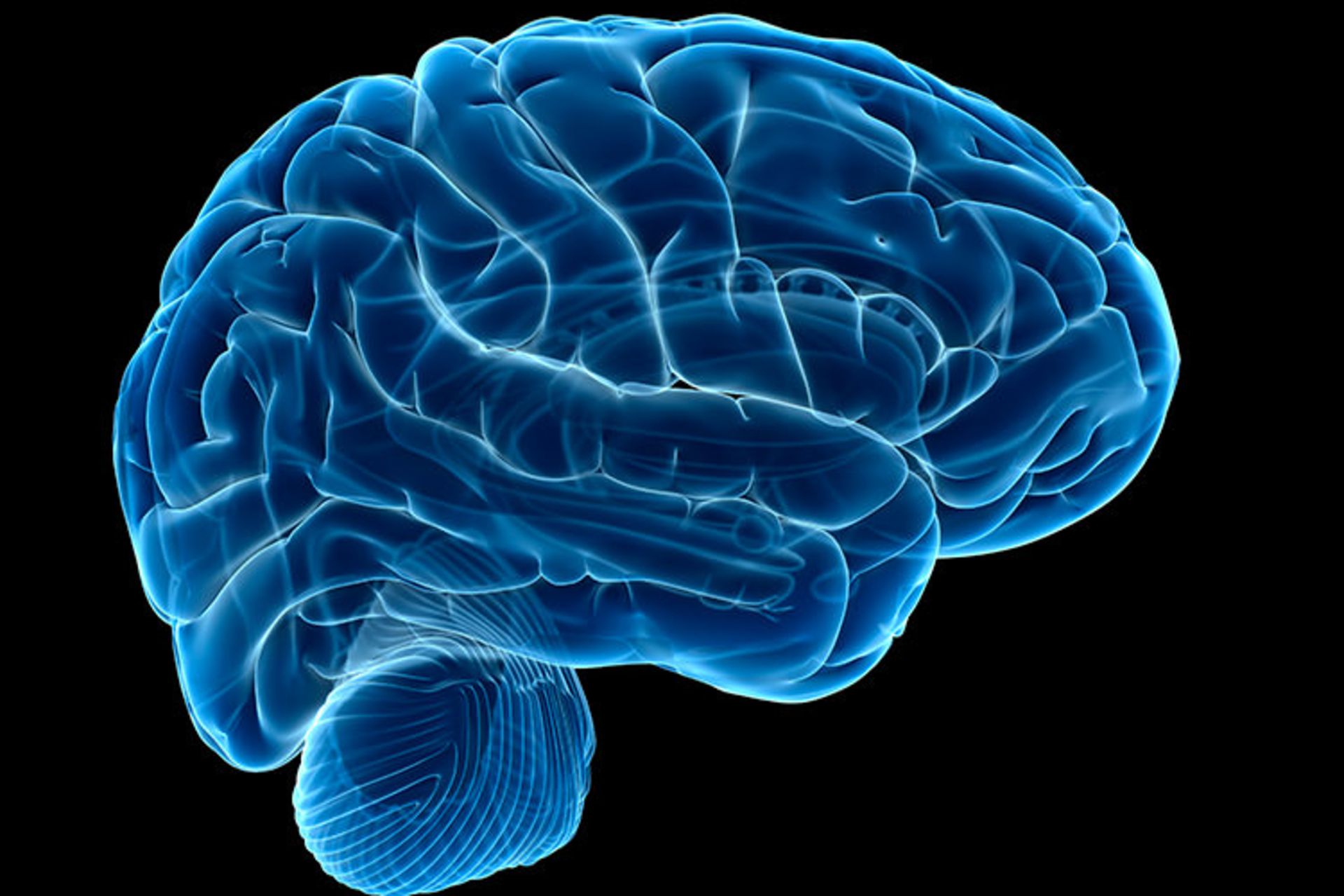 اسکن مغز / Brain Scan