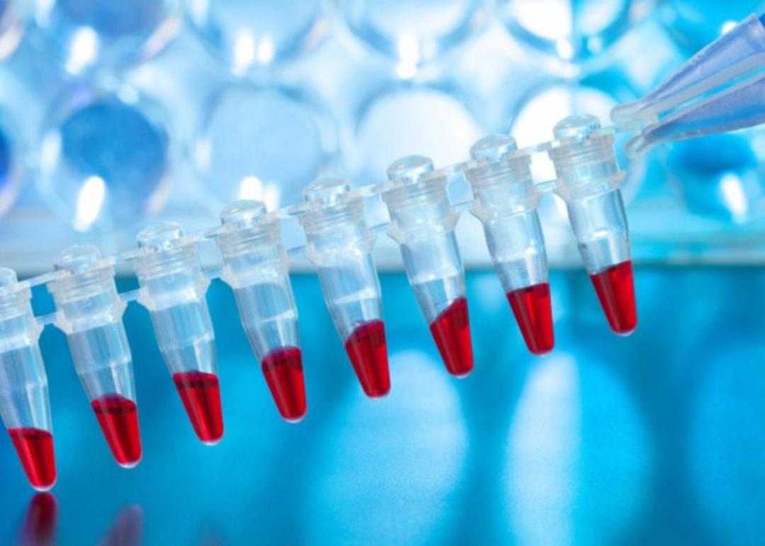 استخراج DNA از خون