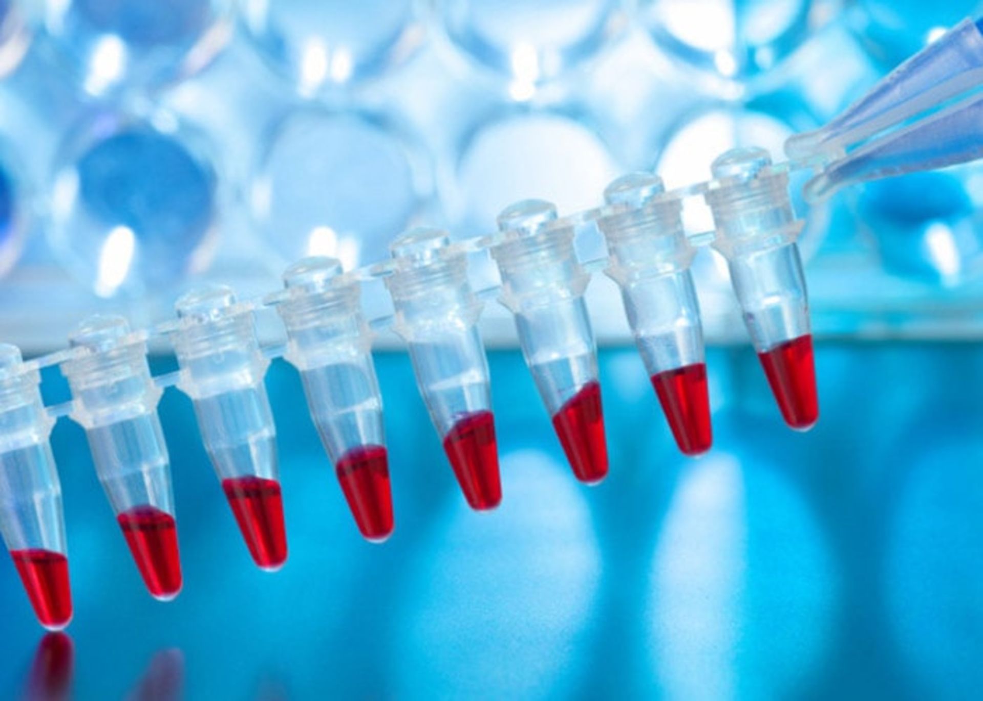 استخراج DNA از خون