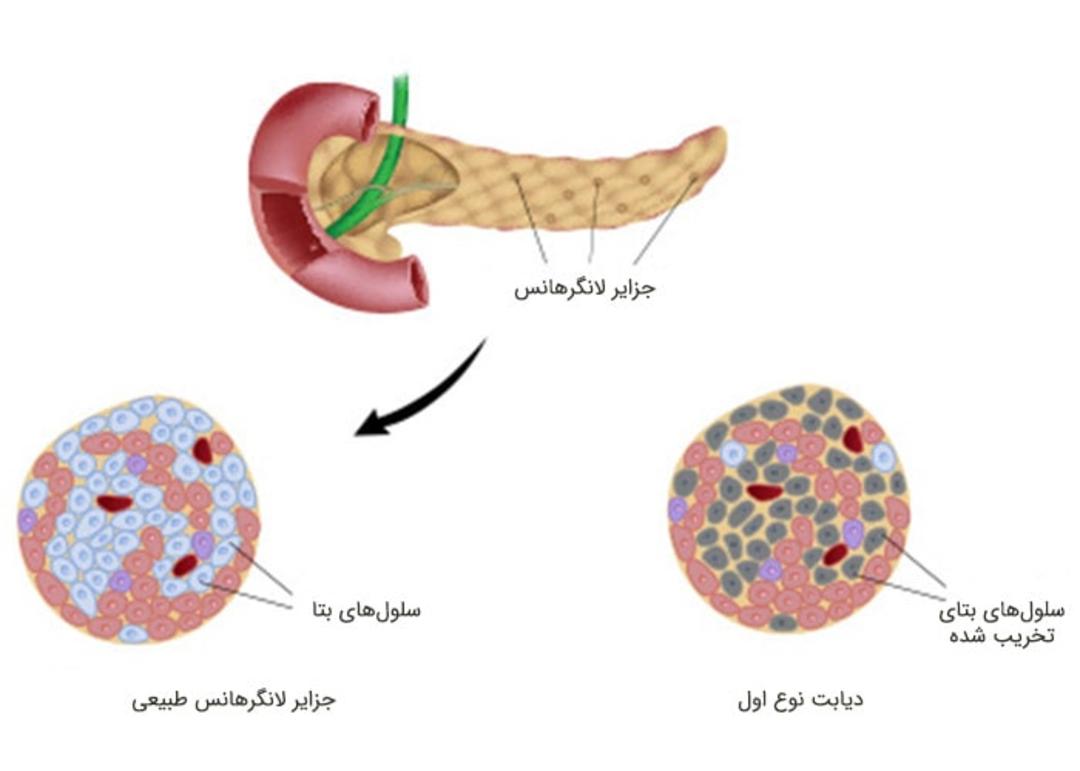 پانکراس 