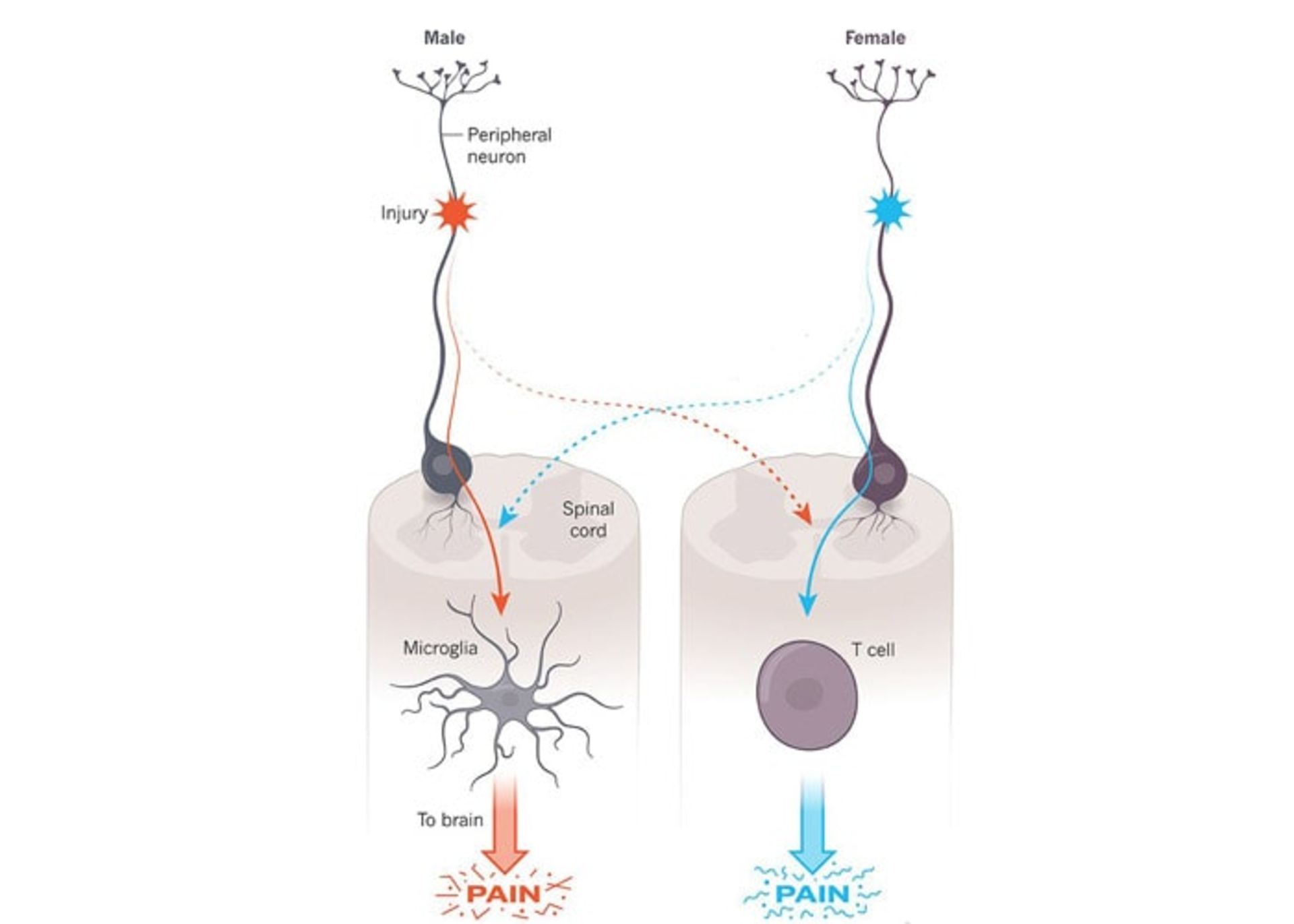 مسیر درد در جنس نر و ماده