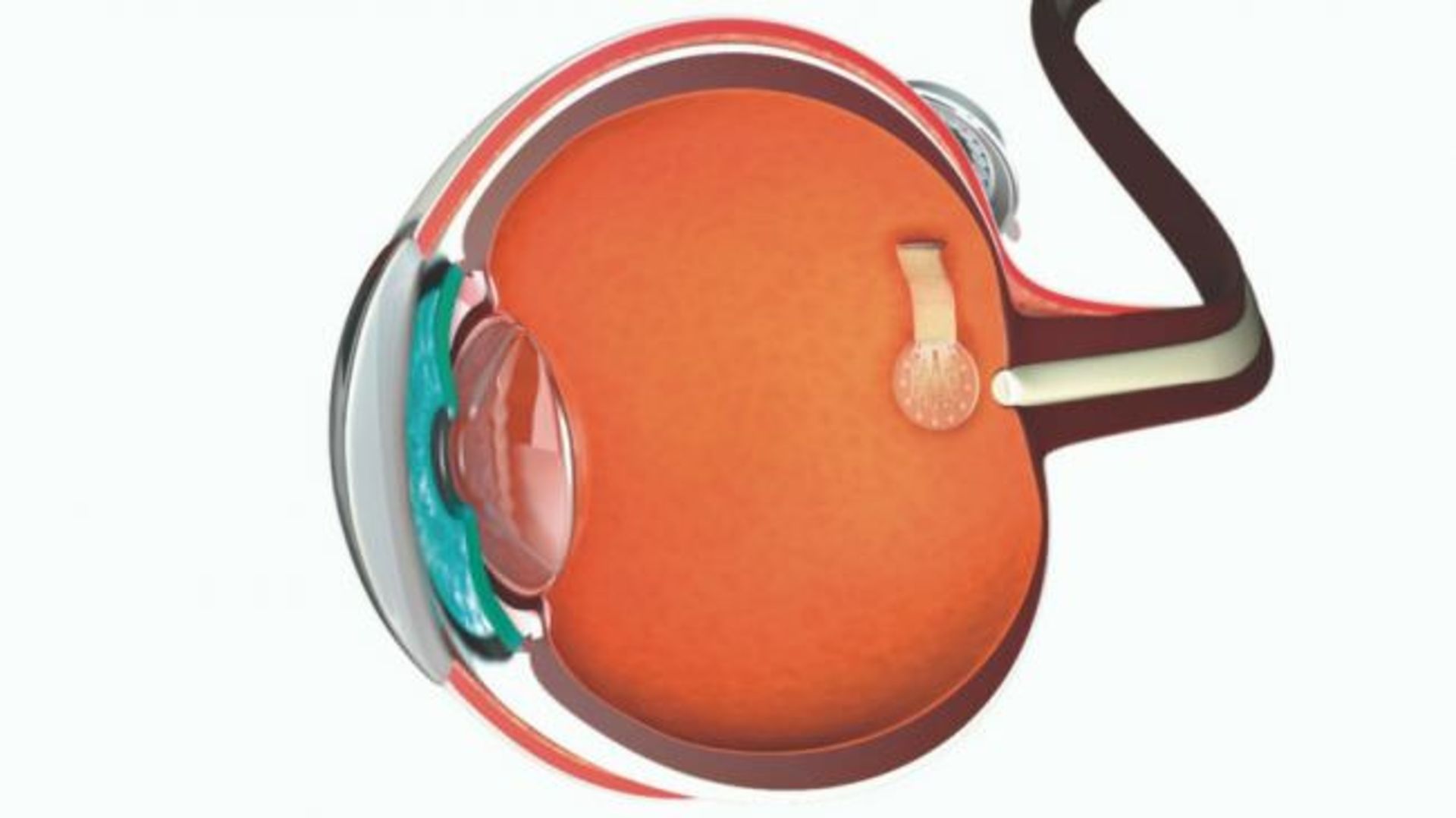 Graphene to cure blindness