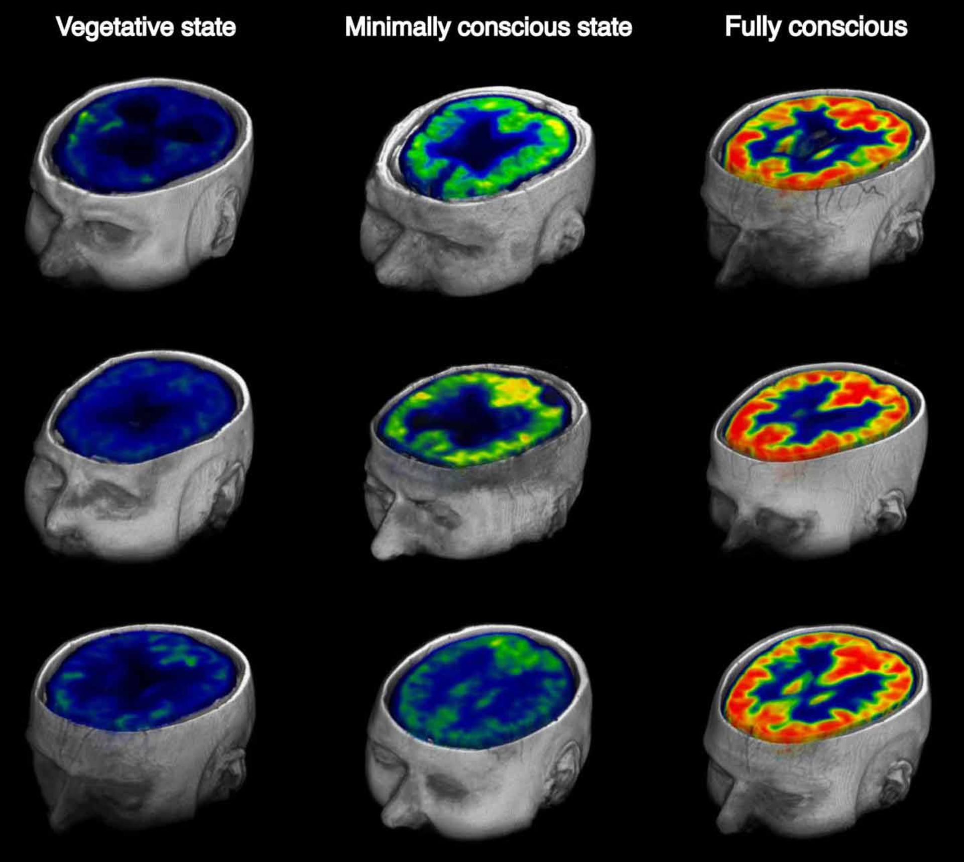 اسکن مغز / brain scan