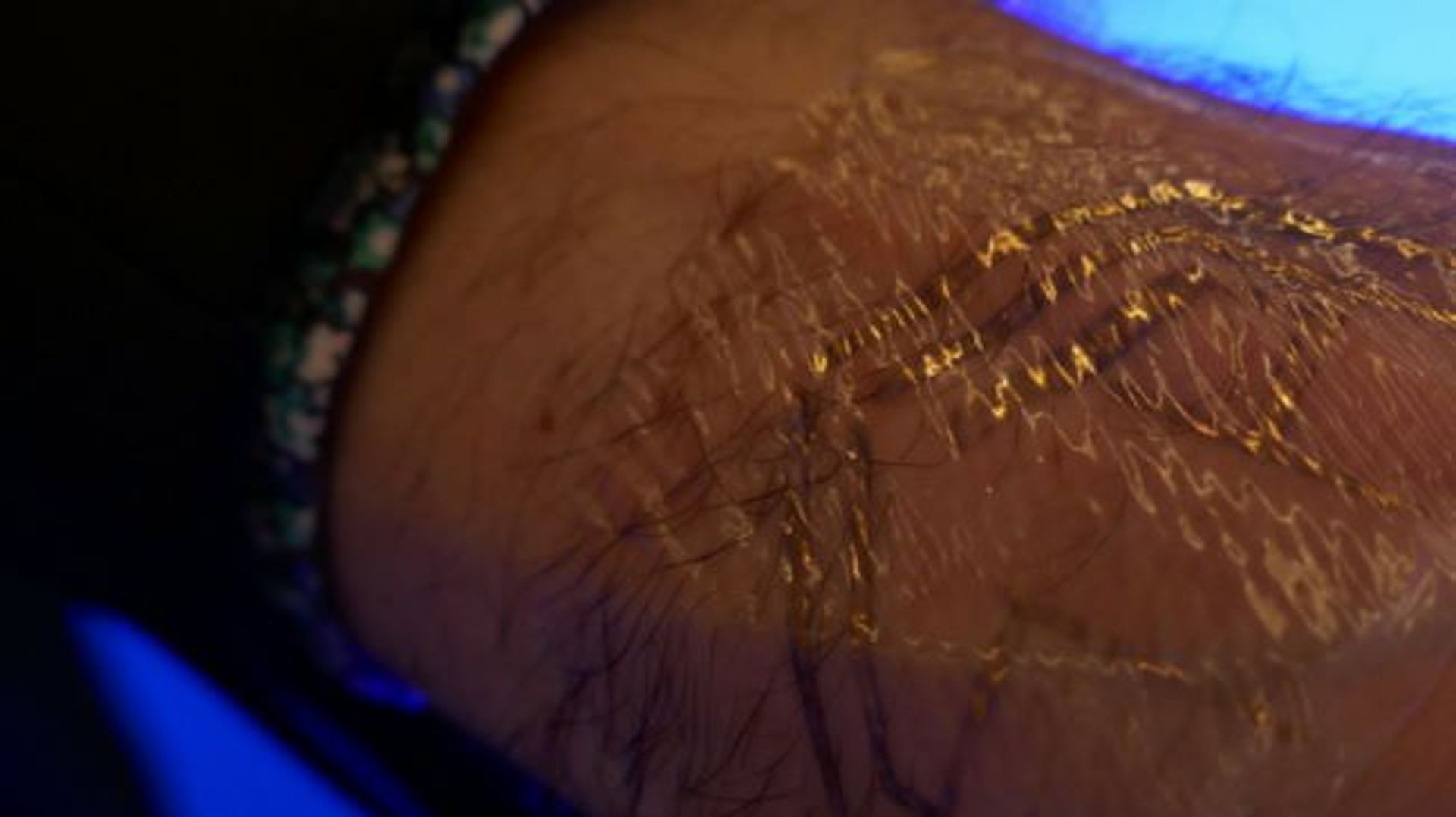 Graphene e-tattoos