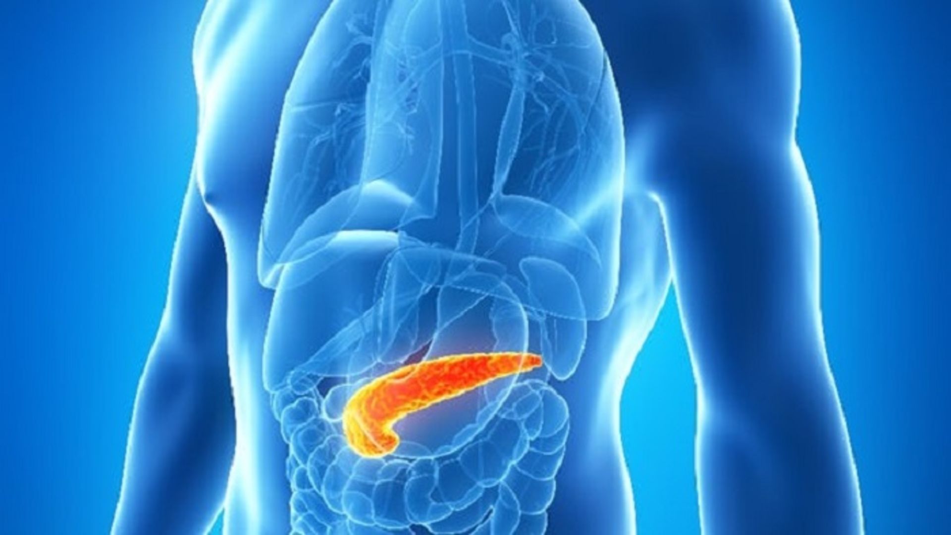 diabetes type 2