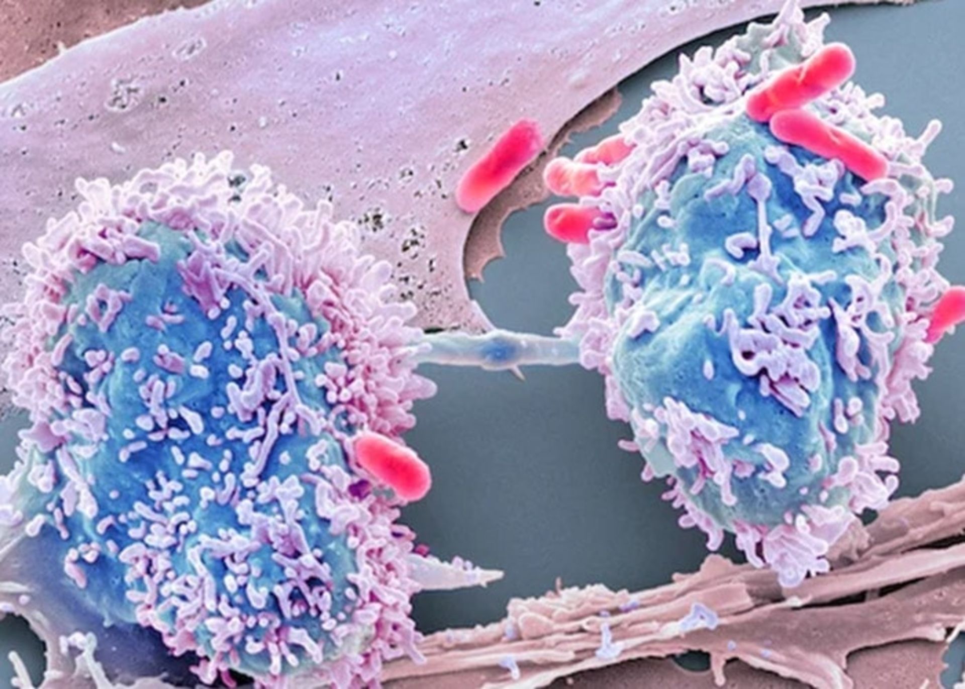 مرجع متخصصين ايران تقسيم سلول سرطاني