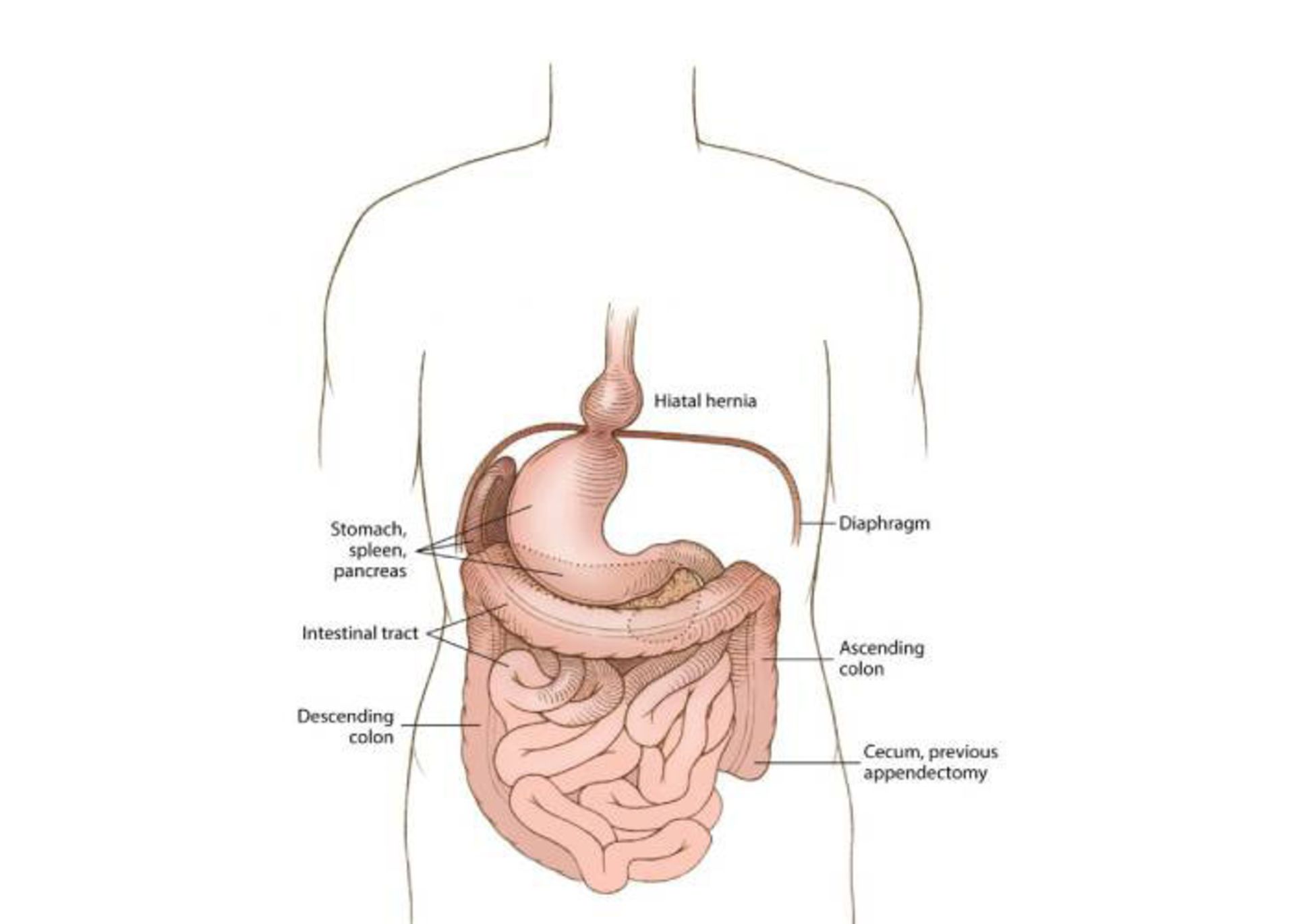 جا به جایی اندام