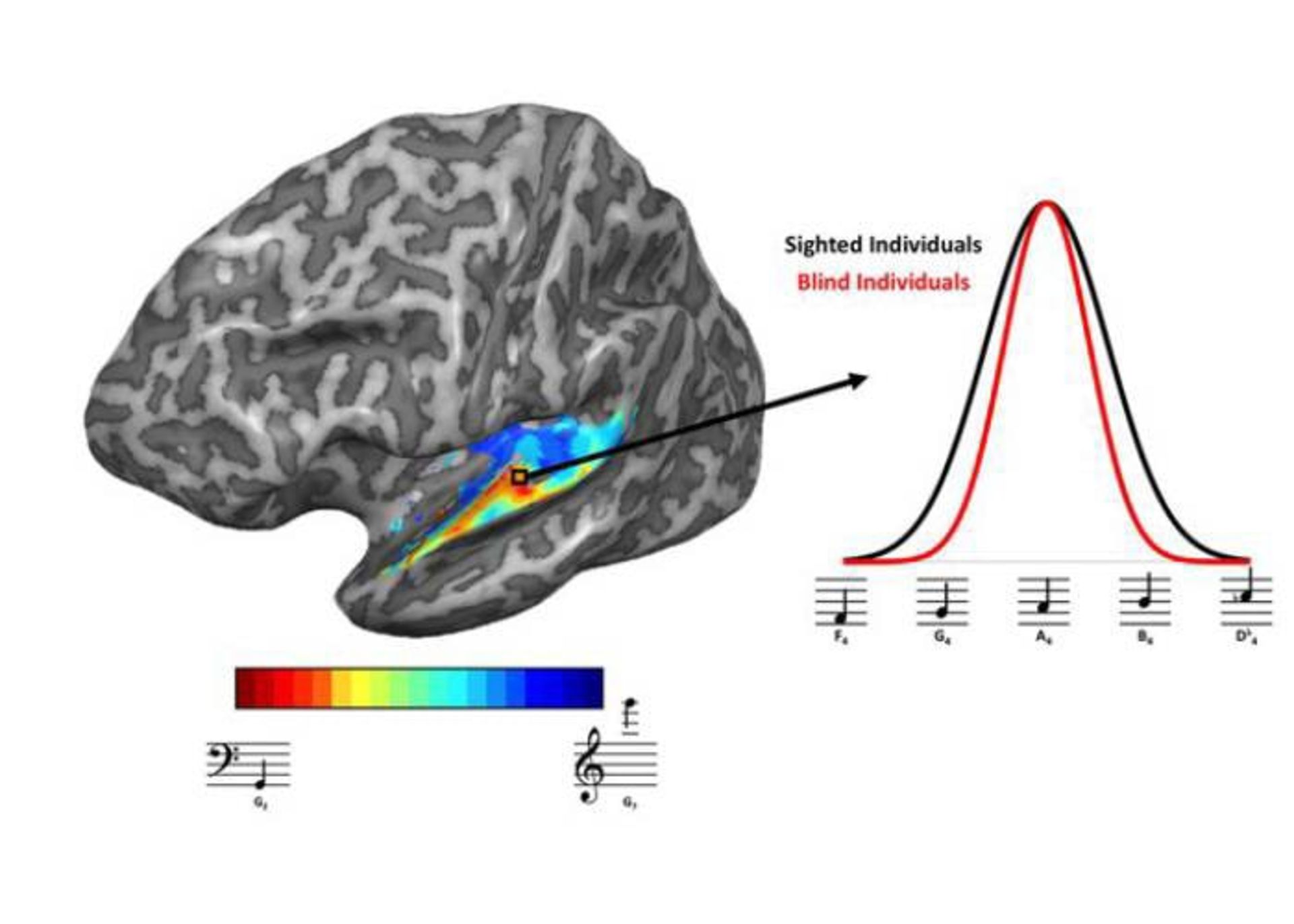 اسکن مغز افراد نابینا