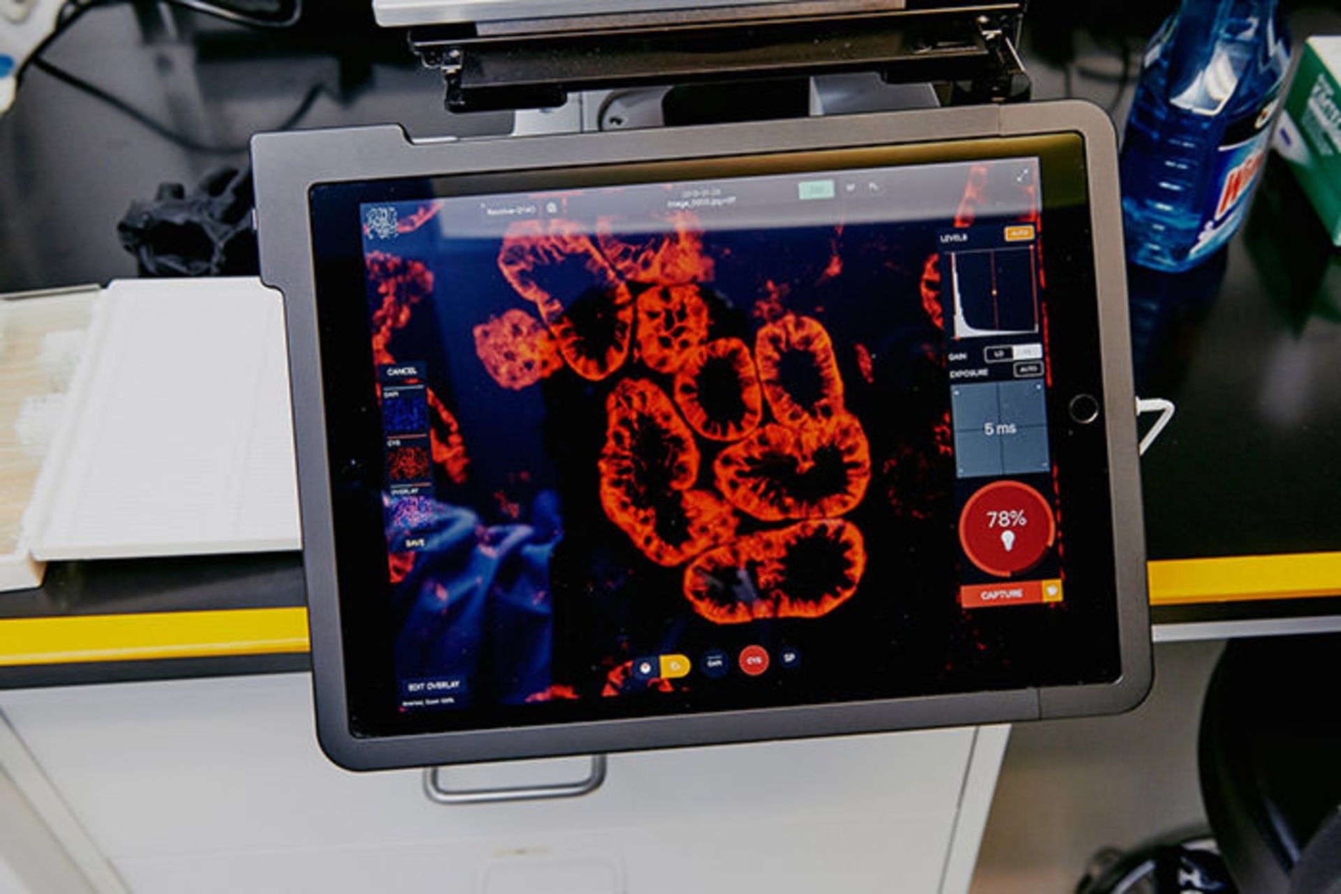 ورقه های ایمونوهیستوشیمی