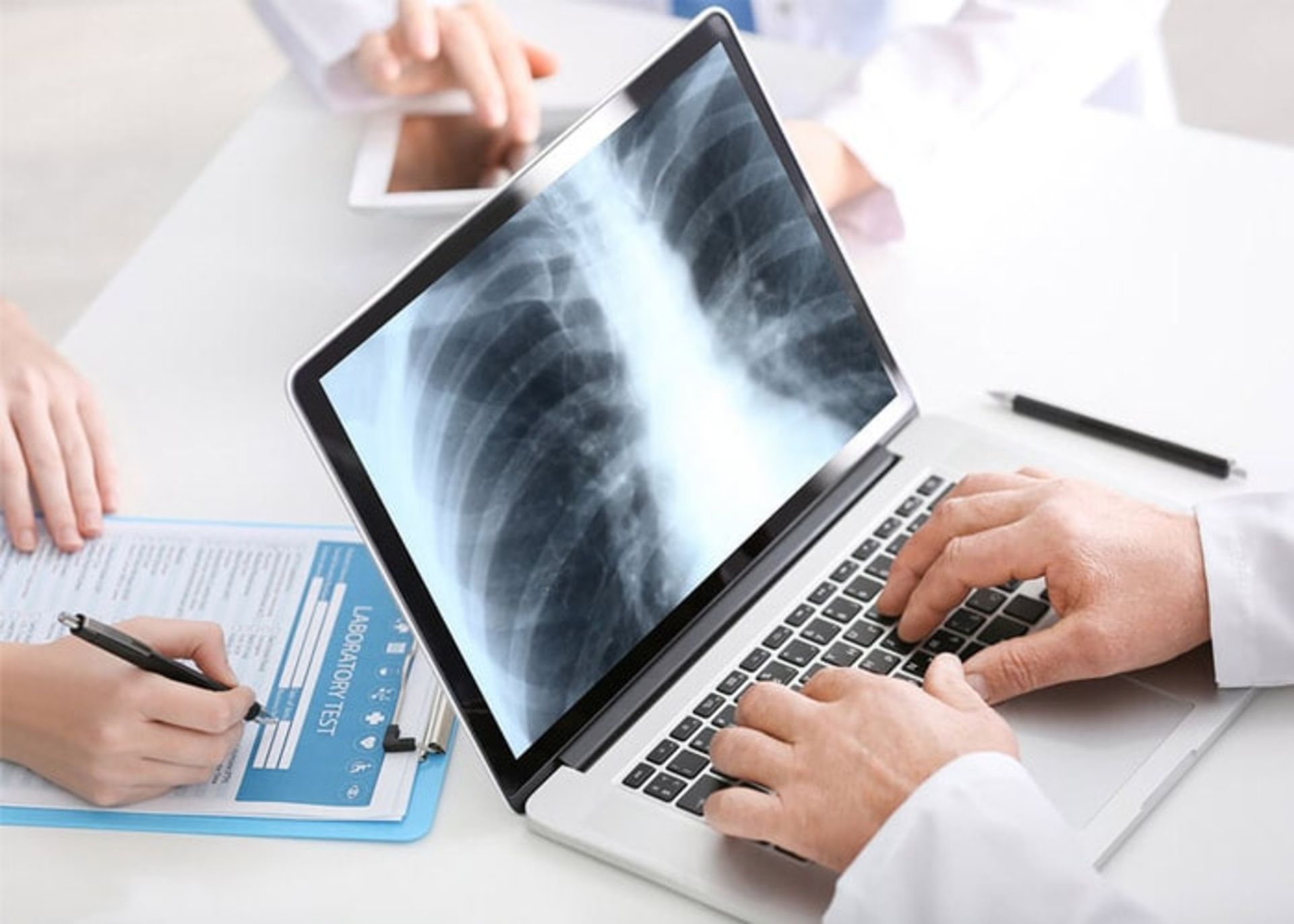 رادیوگرافی قفسه سینه