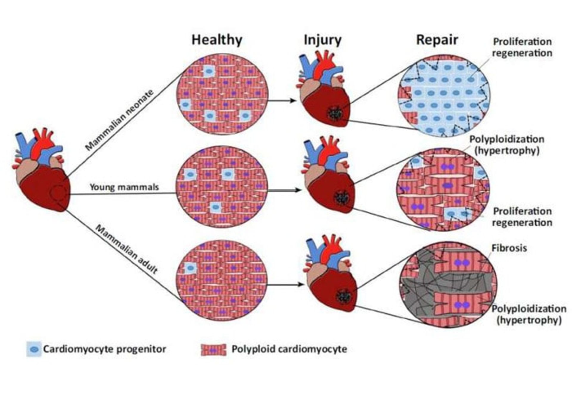 ترمیم نارسایی حاد توسط بدن