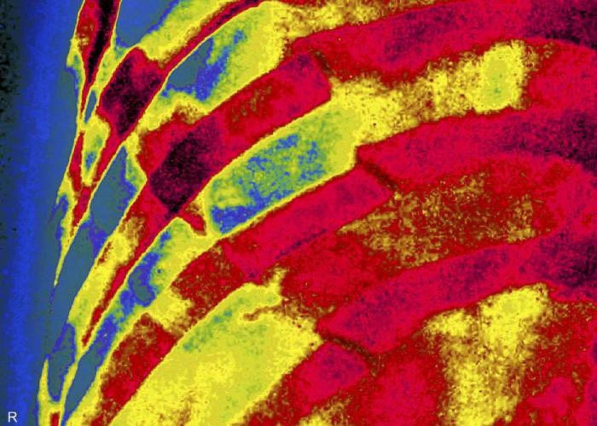 تصویر اشعه ایکس