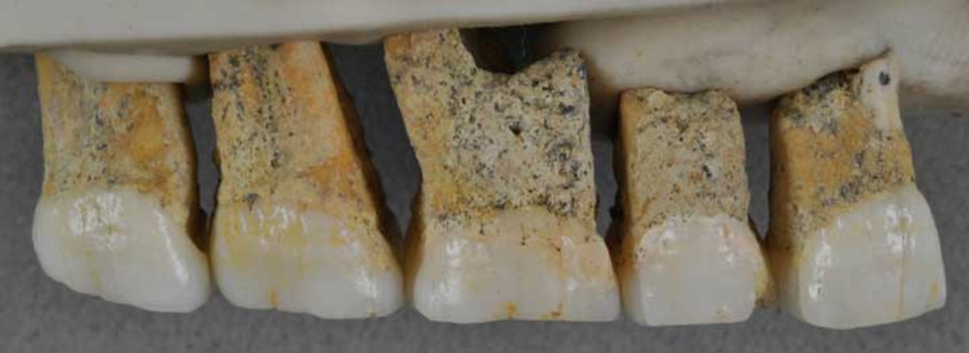 یک ردیف از دندان‌های هومو لوزونسیس