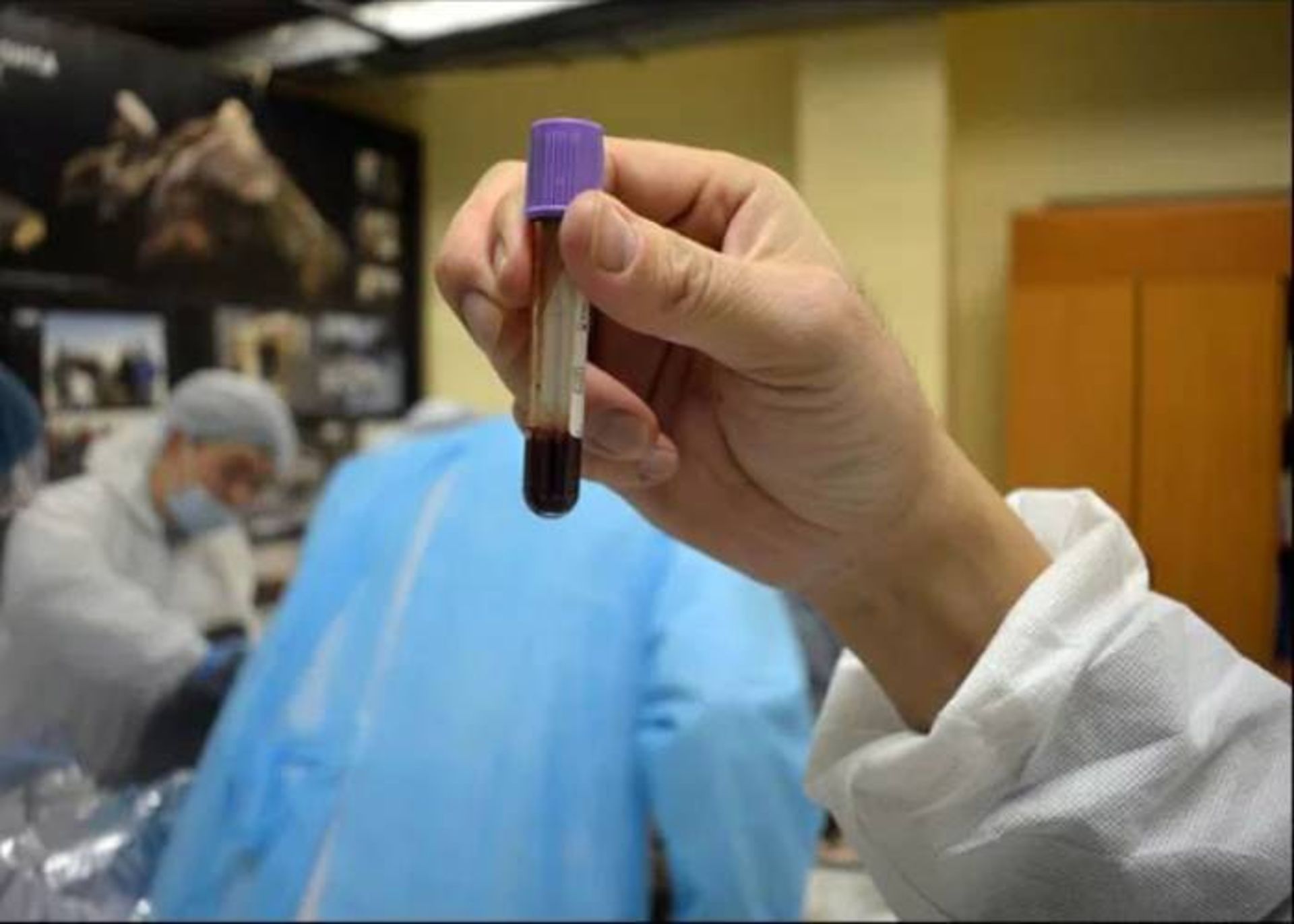 نمونه خون اسب 