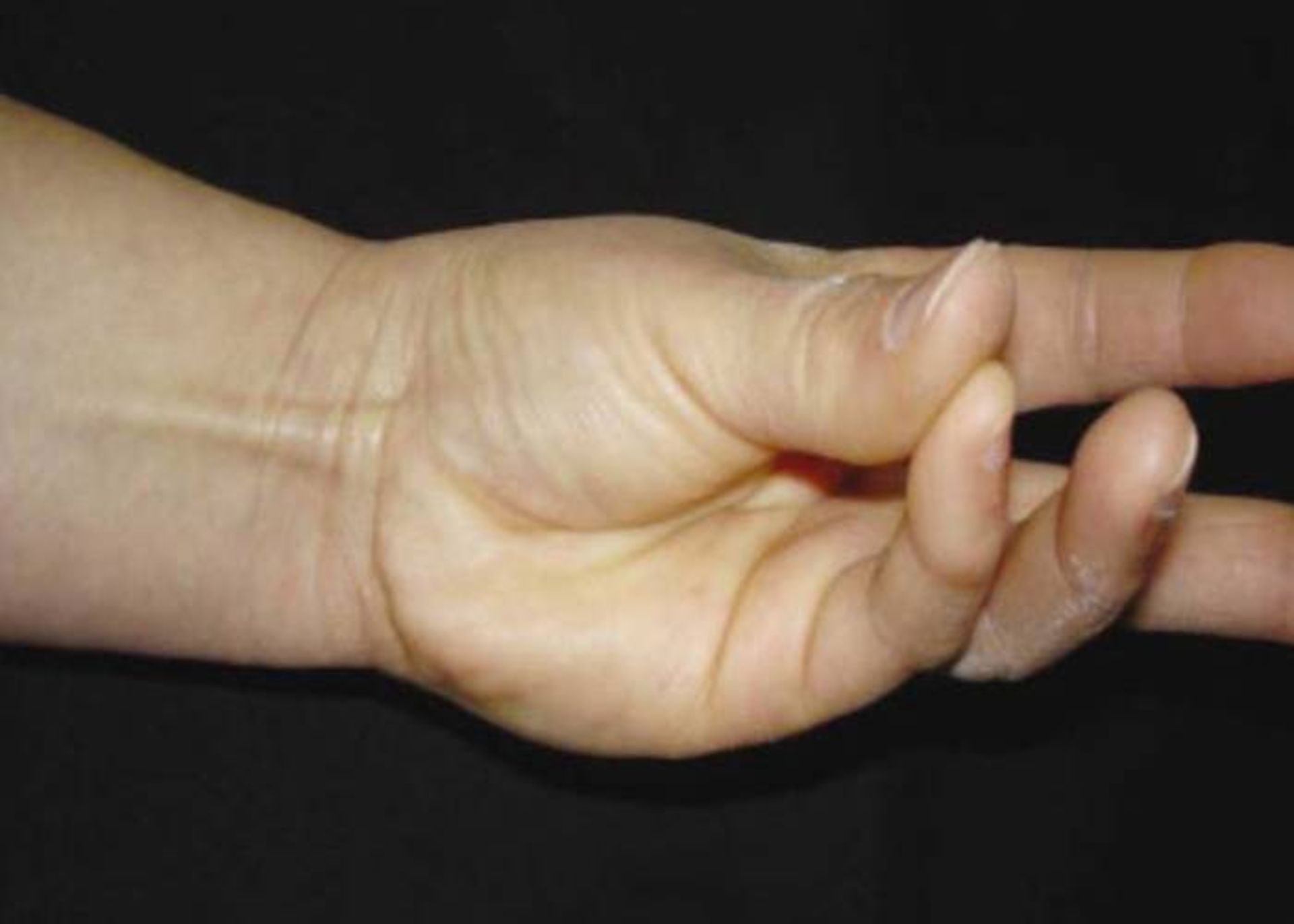 ماهیچه دراز کف دستی