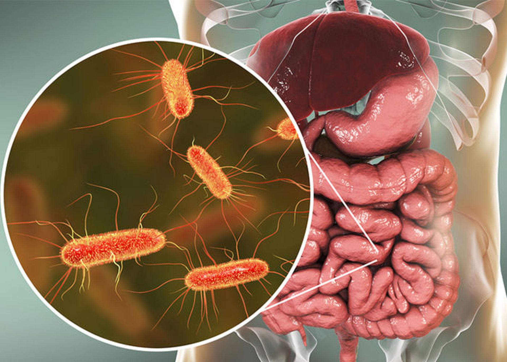 Здоровый кишечник сонненбург. Заболевания от кишечной палочки. Заболевания которые вызывается кишечной палочки. Кишечни ралочки. Симптомы палочки в кишечнике.