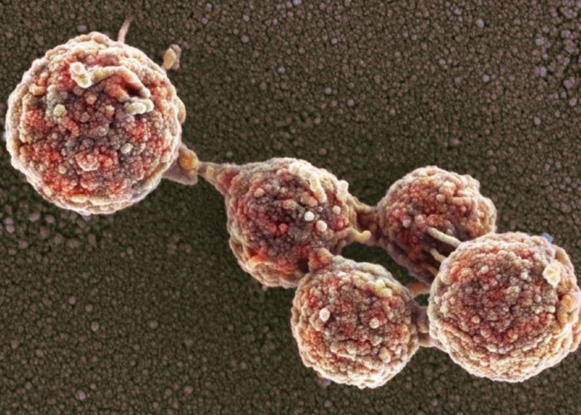 مایکوپلاسما مایکوئید