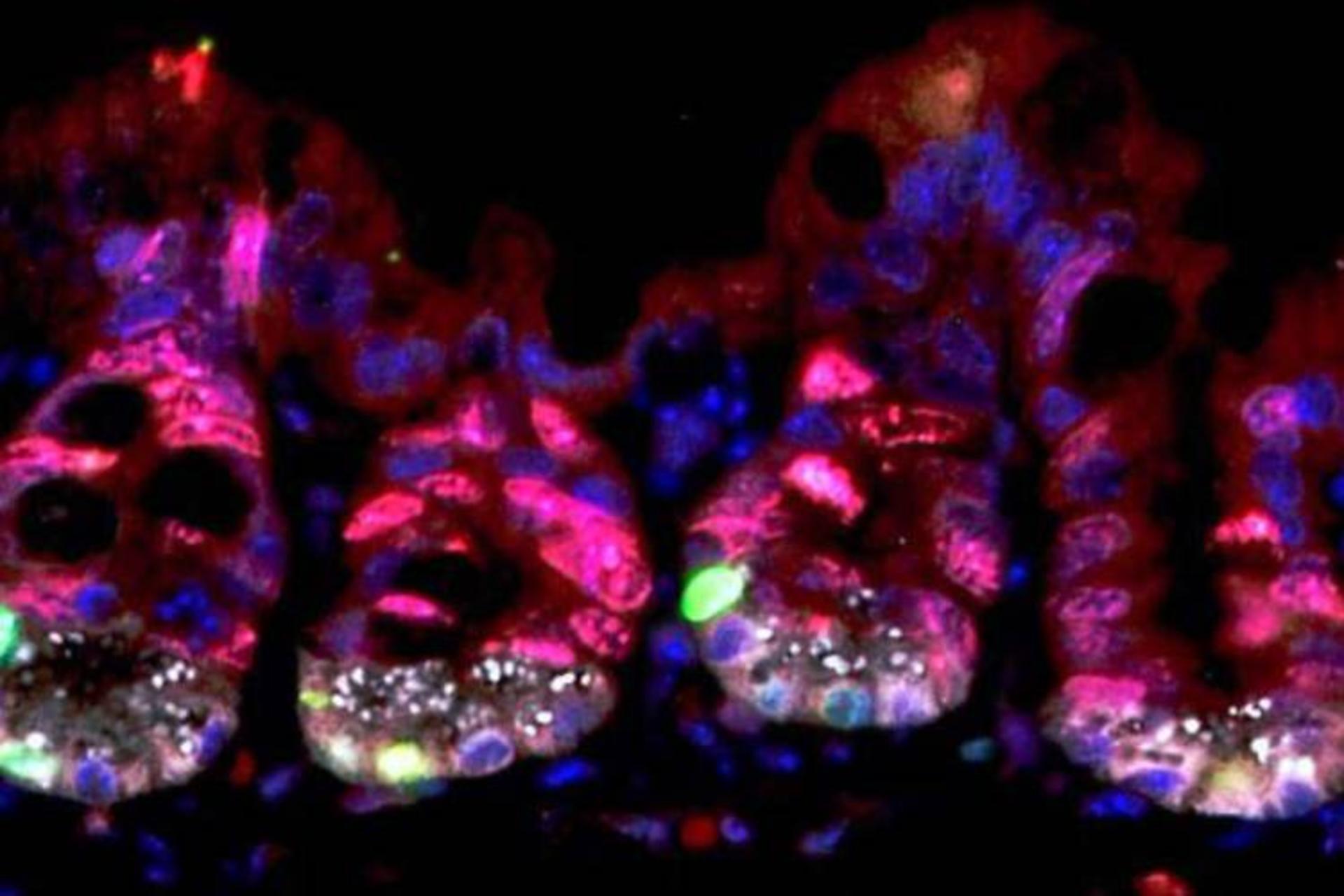 کشف روشی برای محافظت دربرابر آسیب ناشی از تابش شدید اشعه