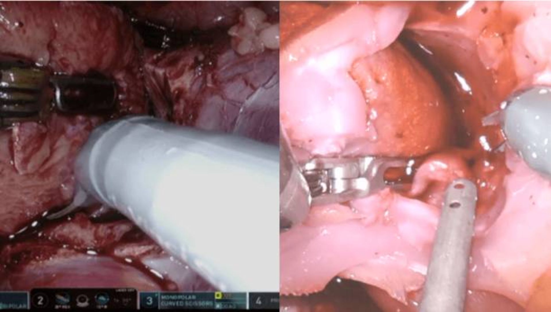 چاپ سه بعدی اعضای بدن