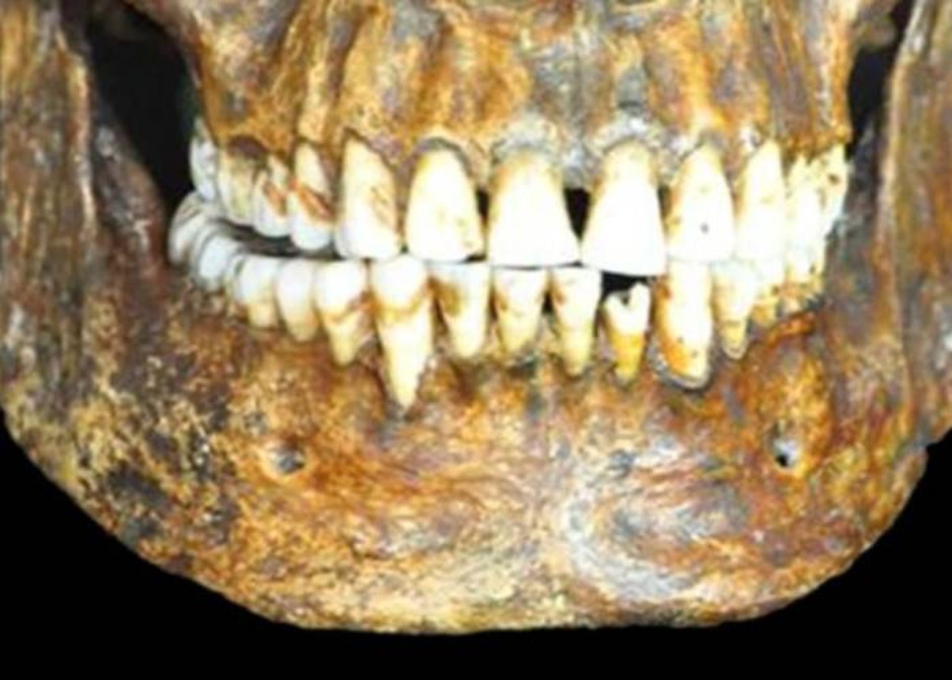 مرجع متخصصين ايران دندان باستاني