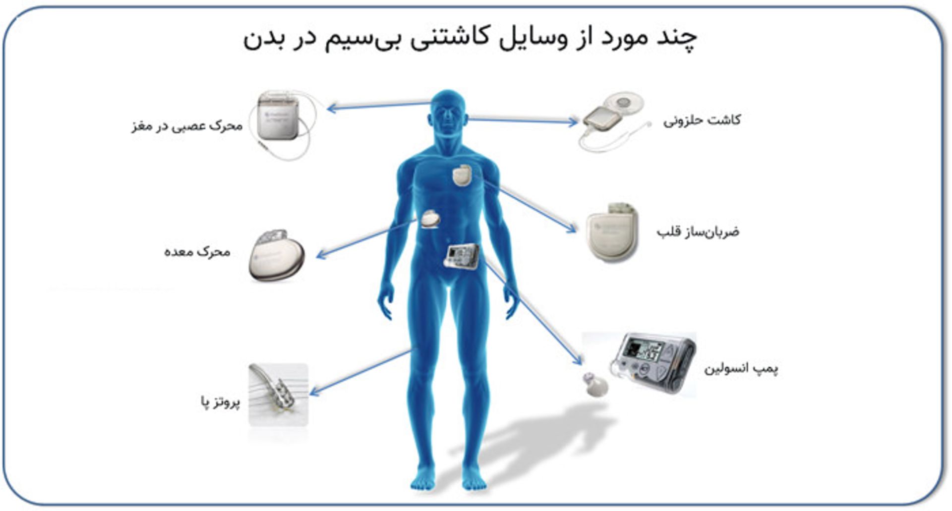 وسایل کاشتنی بی سیم در بدن