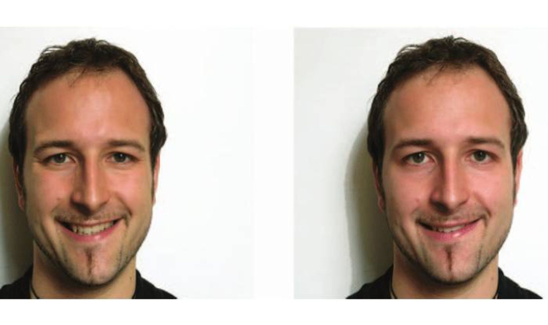 خنده دوشن و غیردوشن