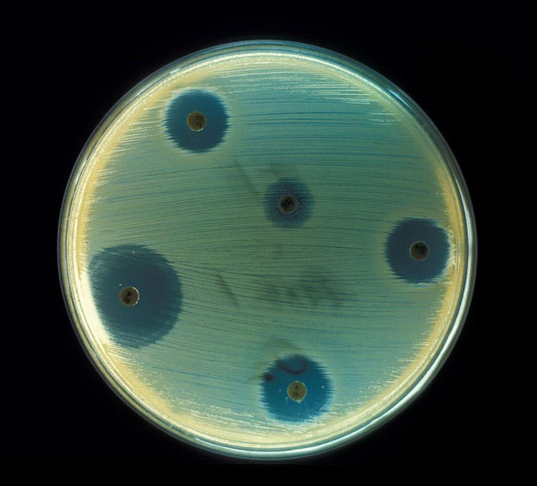 الکساندر فلمینگ / Alexander Fleming