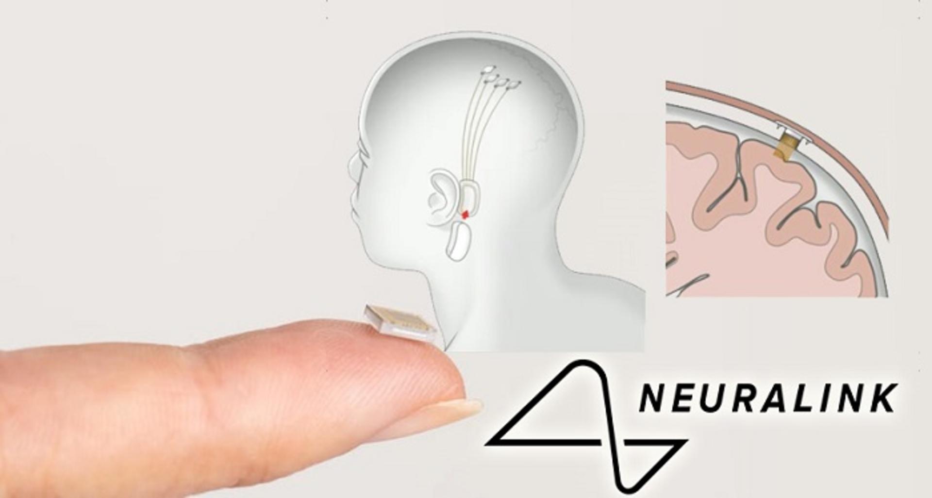neuralink