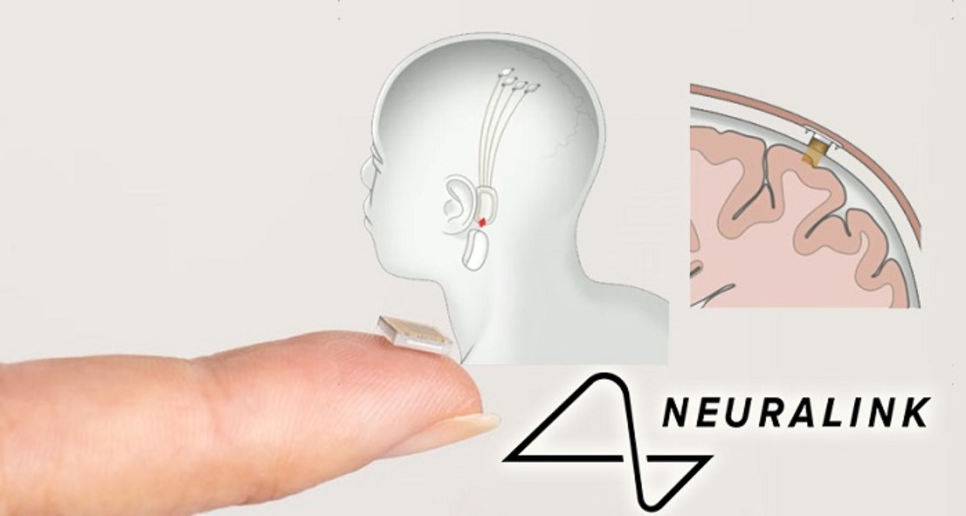 neuralink