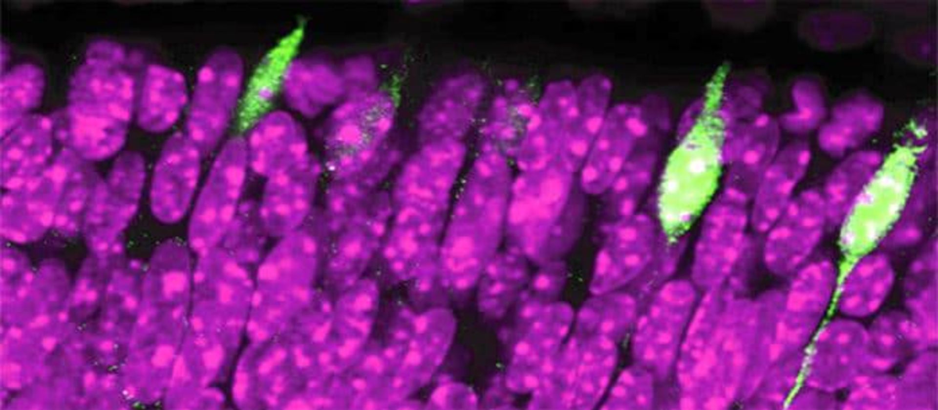 سلول های گیرنده نور در چشم