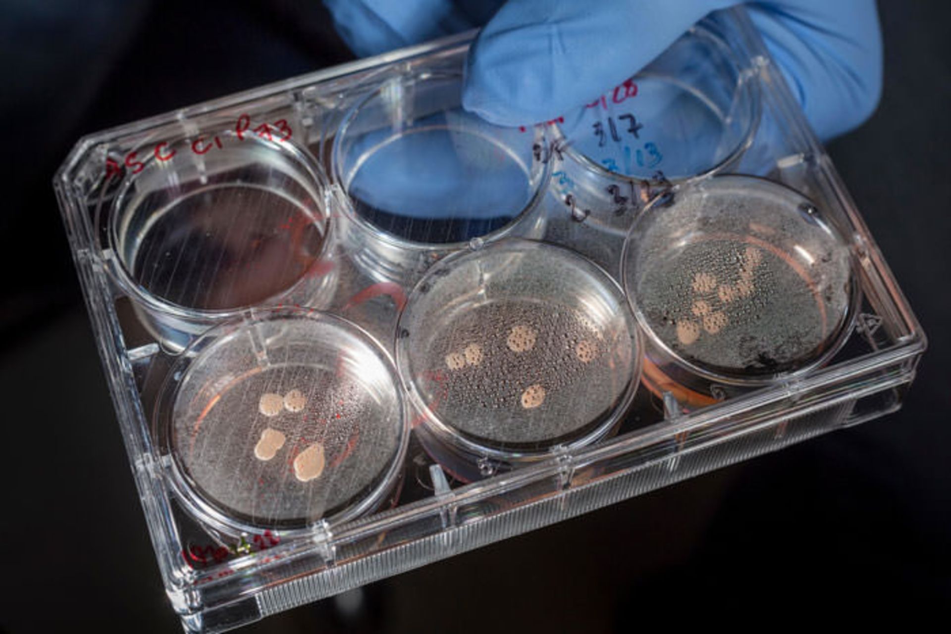ارگانوئید مغزی / brain organoid