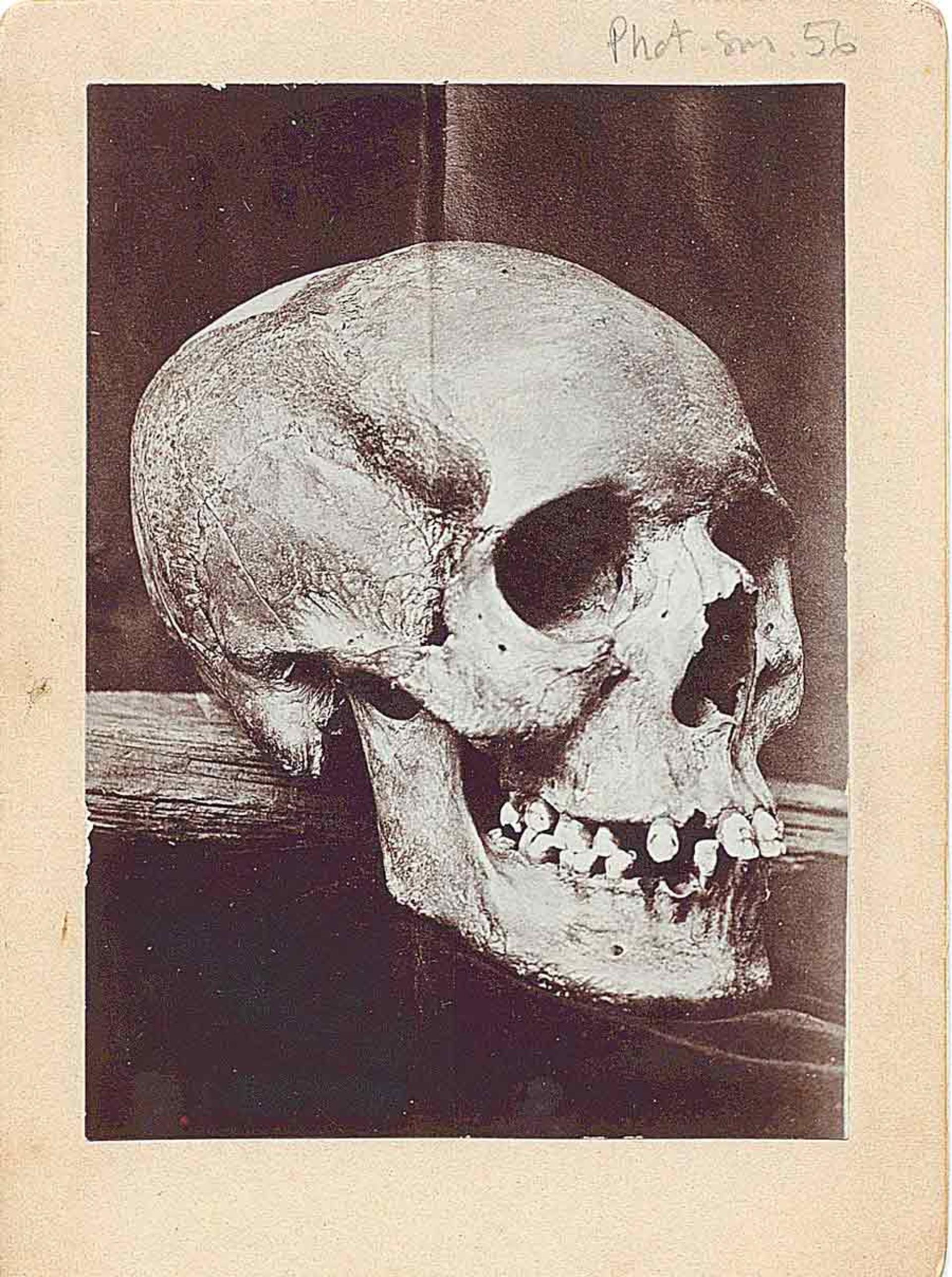 کسی که مشاهده می‌کنید بیش از ۱۰۰ سال قبل از جمجمه ادی گرفته شده است.