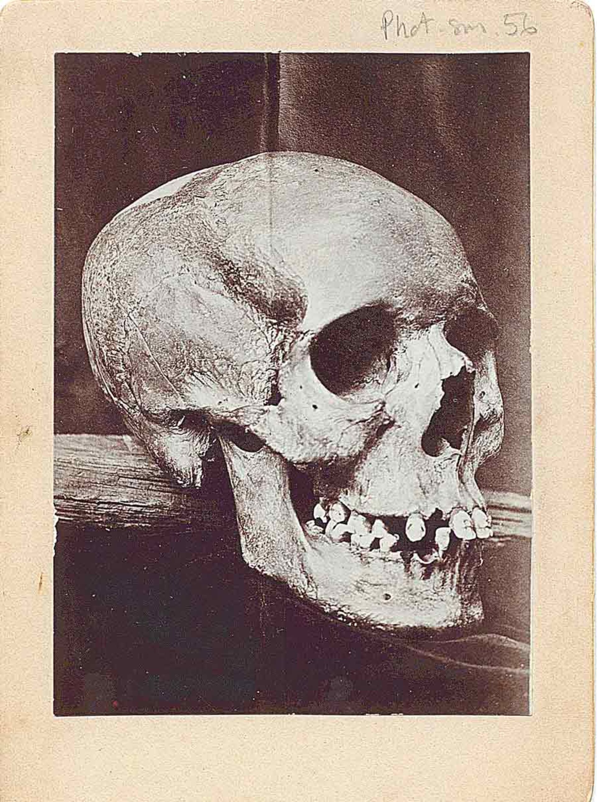 کسی که مشاهده می‌کنید بیش از ۱۰۰ سال قبل از جمجمه ادی گرفته شده است.